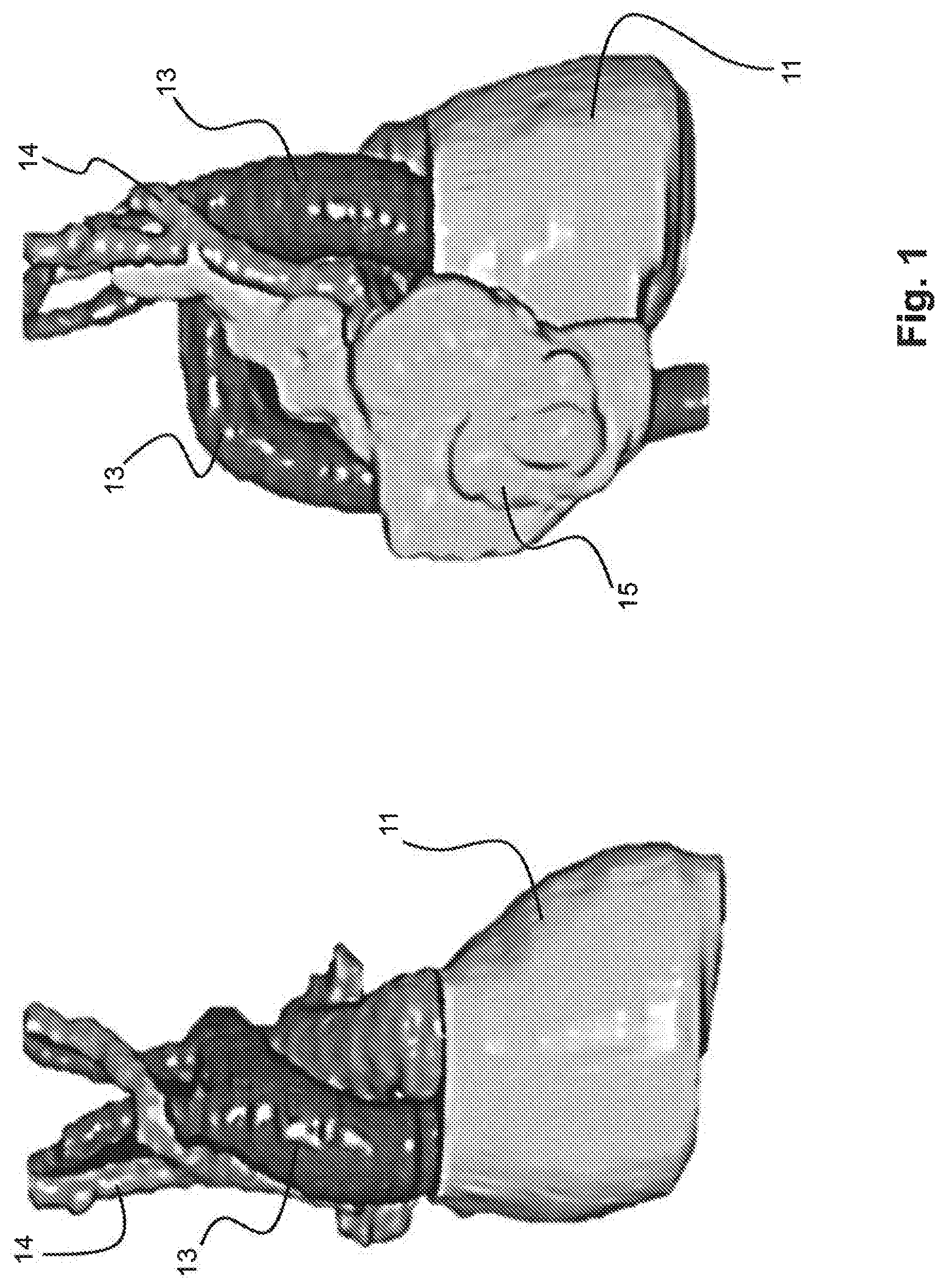 Patent US12102842 Figure 1 – Treatment and planning for lymphocytes sparing radiotherapy