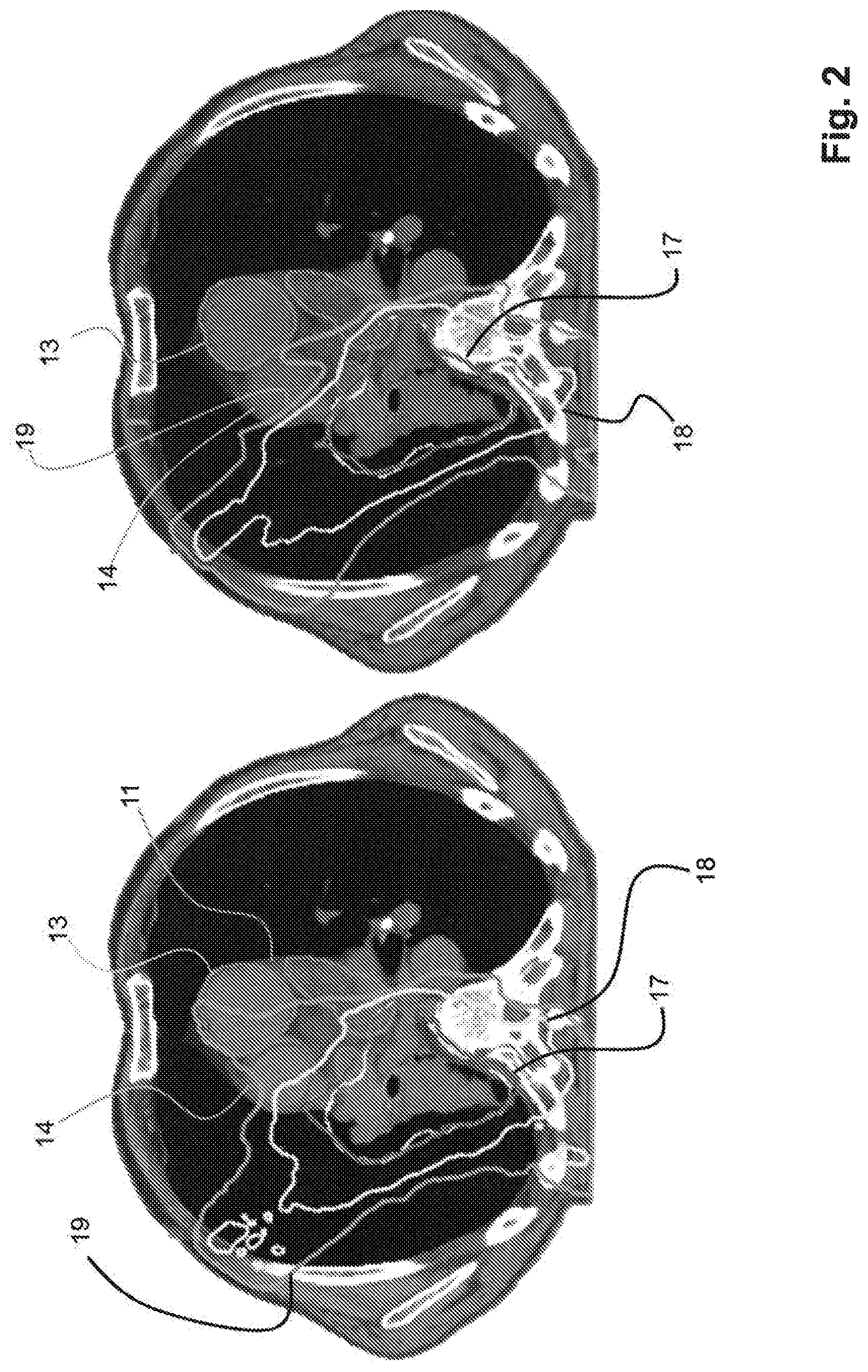 Patent US12102842 Figure 2 – Treatment and planning for lymphocytes sparing radiotherapy