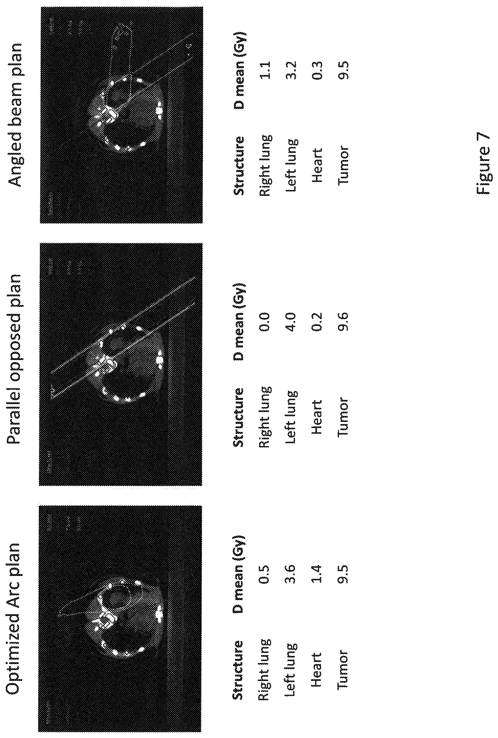 Patent US12102842 Figure 7 – Treatment and planning for lymphocytes sparing radiotherapy