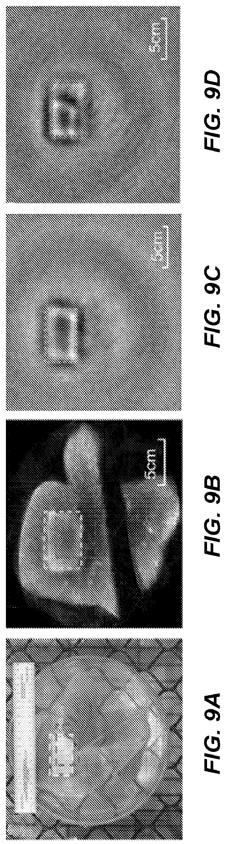 Patent US12102843 Figure 9 – Combined radiation acoustics and ultrasound for radiotherapy guidance and cancer targeting