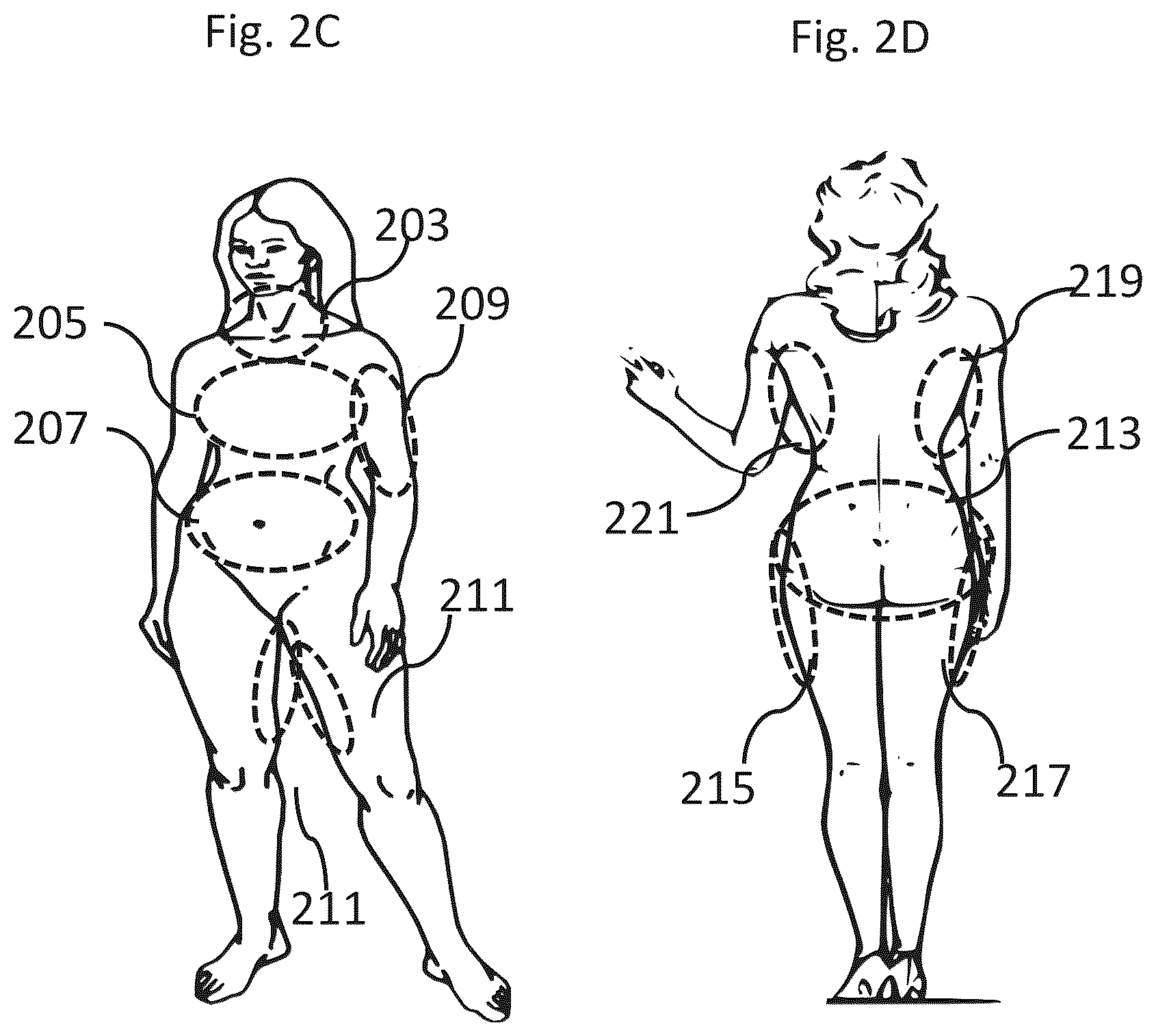 Patent US12102844 Figure 4 – Fat tissue treatment