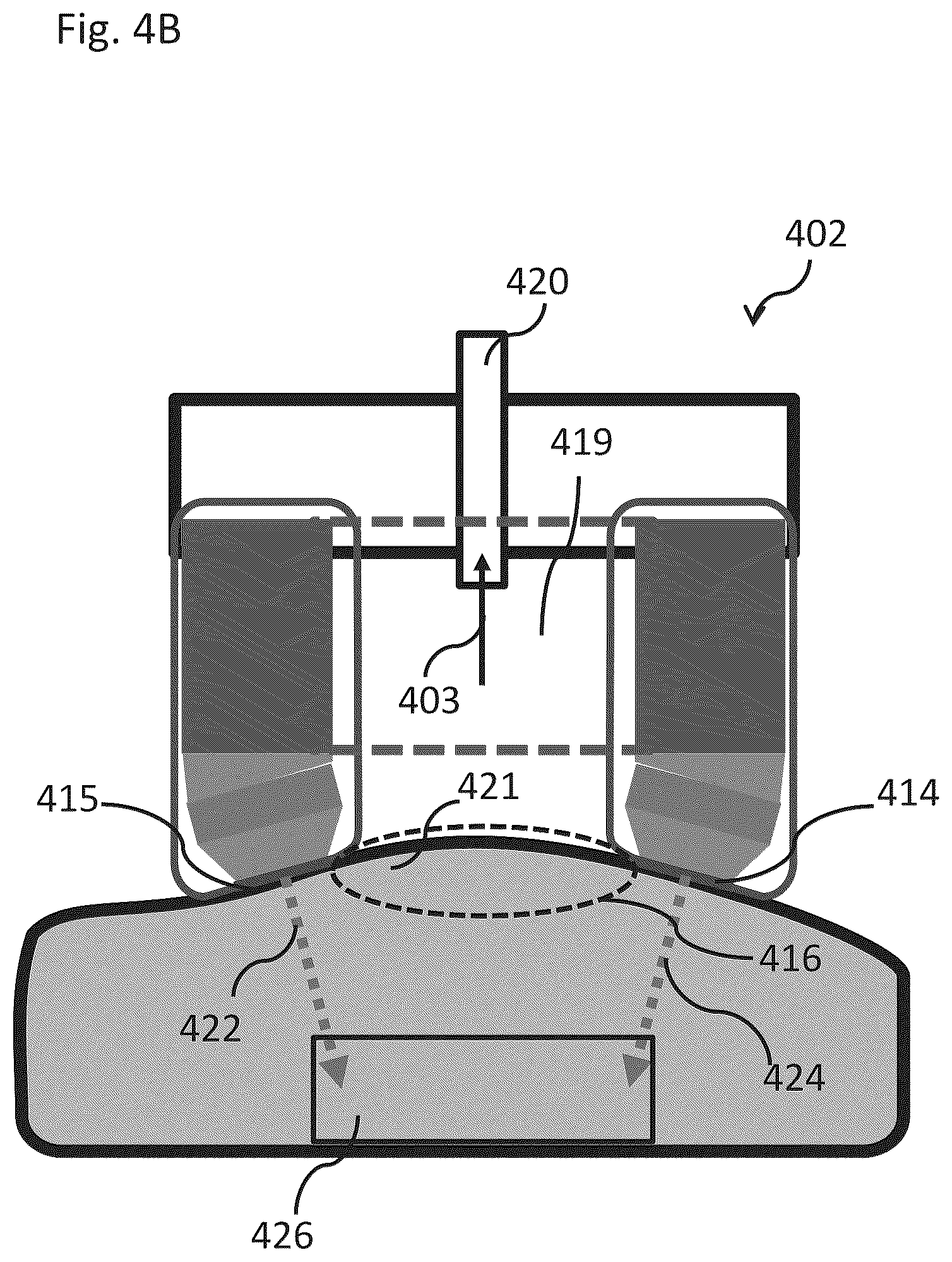 Patent US12102844 Figure 11 – Fat tissue treatment