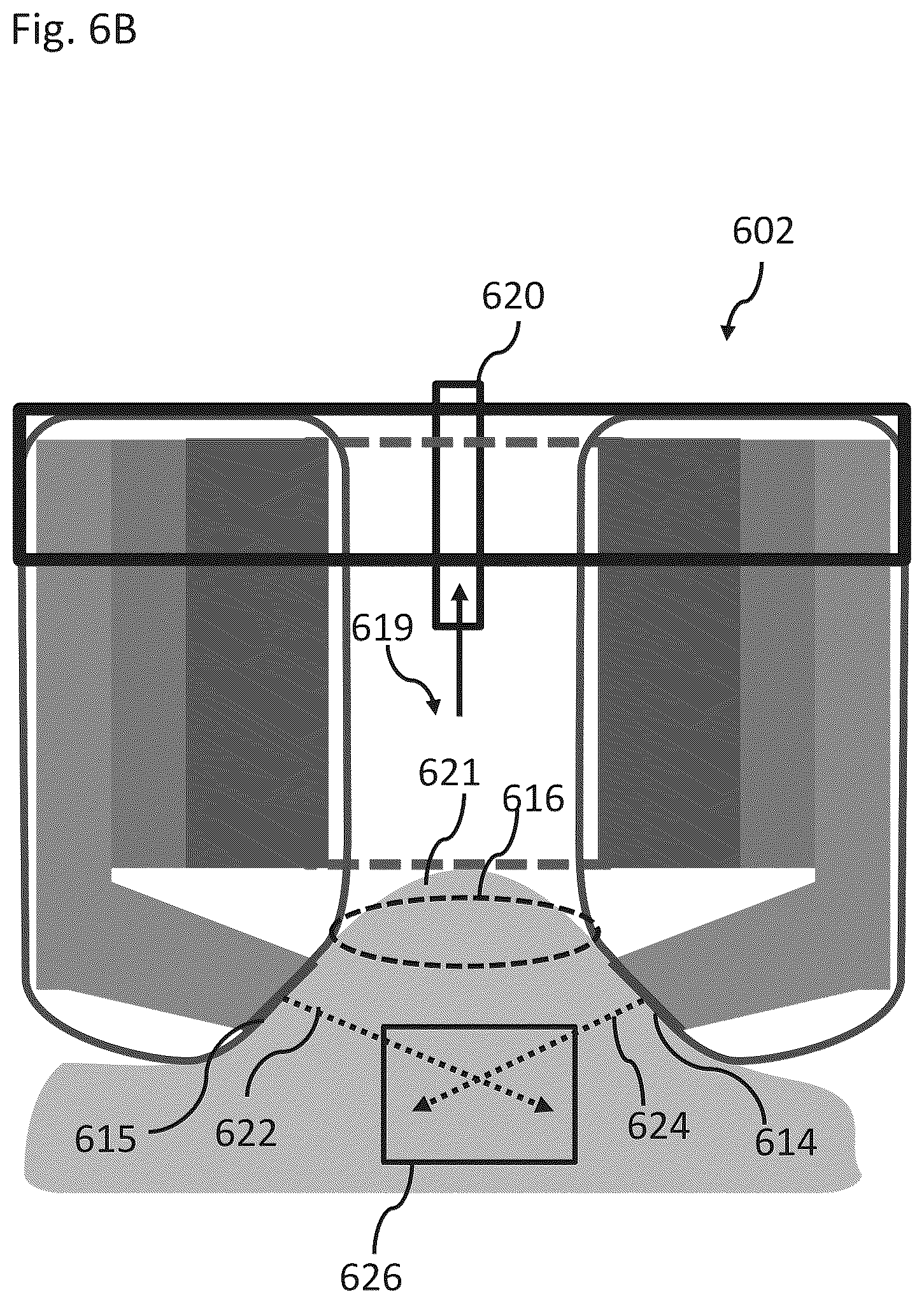 Patent US12102844 Figure 15 – Fat tissue treatment