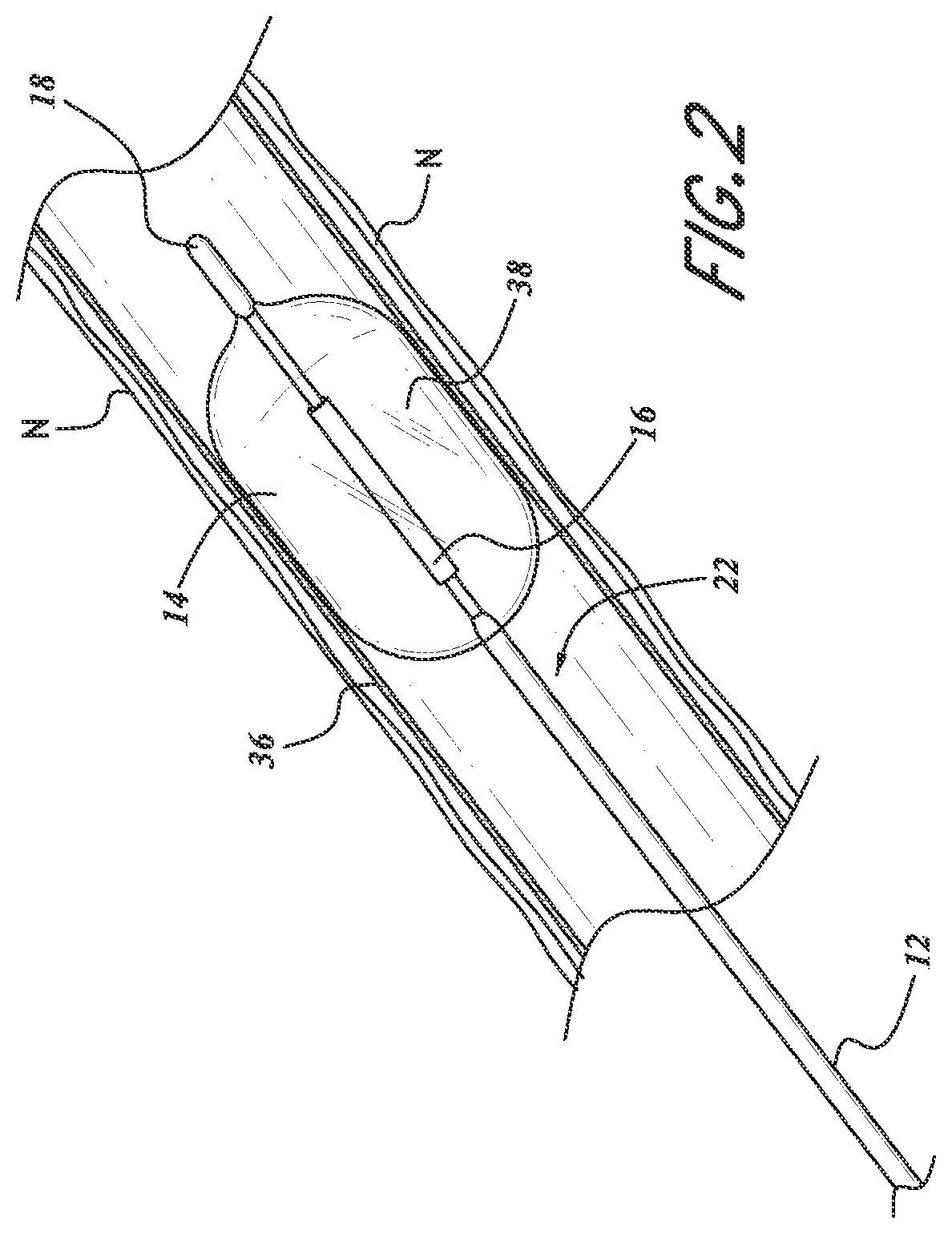 Patent US12102845 Figure 2 – Ultrasound-based neuromodulation system