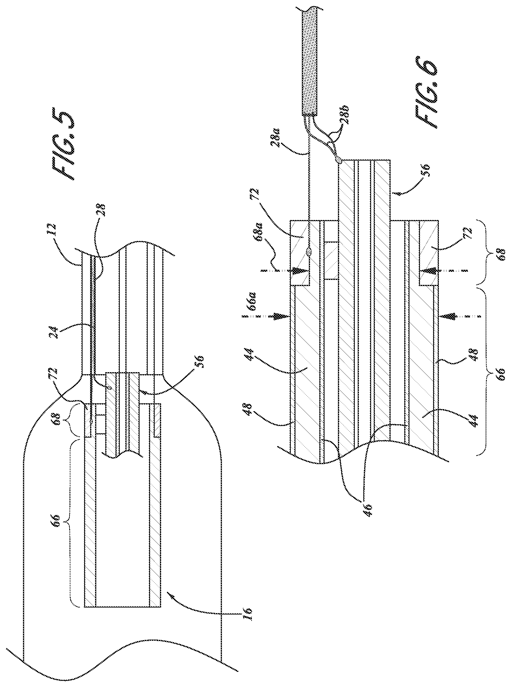 Patent US12102845 Figure 4 – Ultrasound-based neuromodulation system