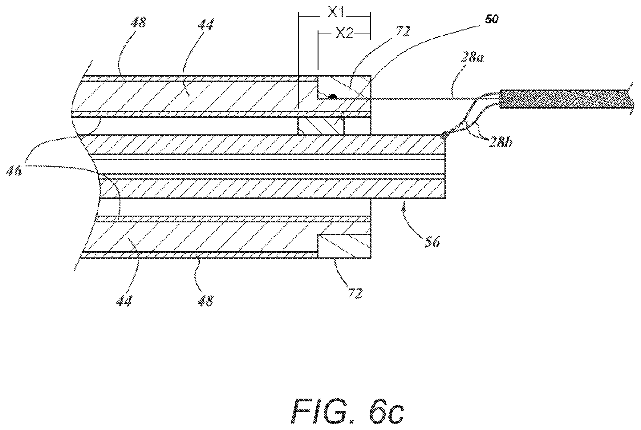 Patent US12102845 Figure 6 – Ultrasound-based neuromodulation system