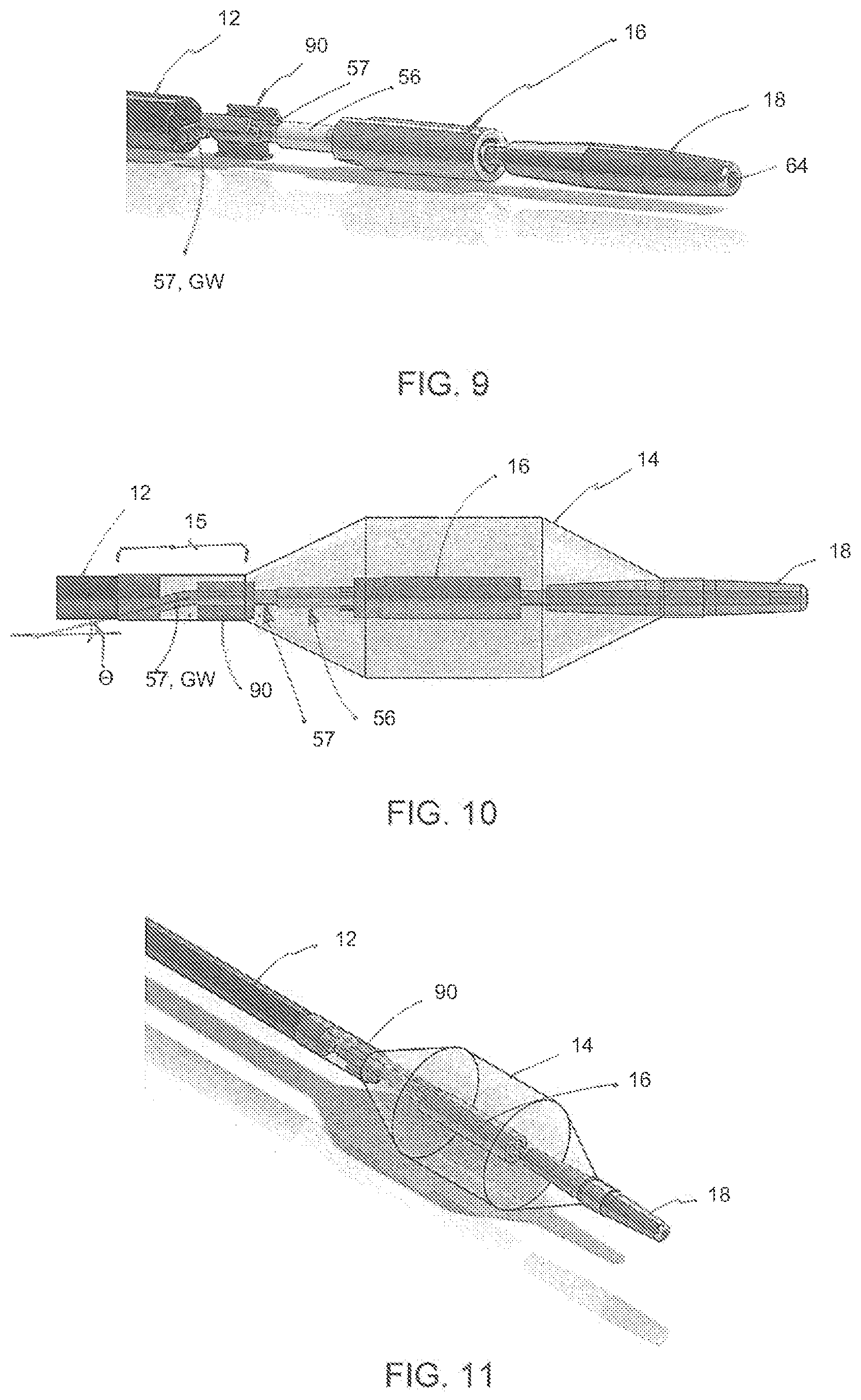 Patent US12102845 Figure 9 – Ultrasound-based neuromodulation system
