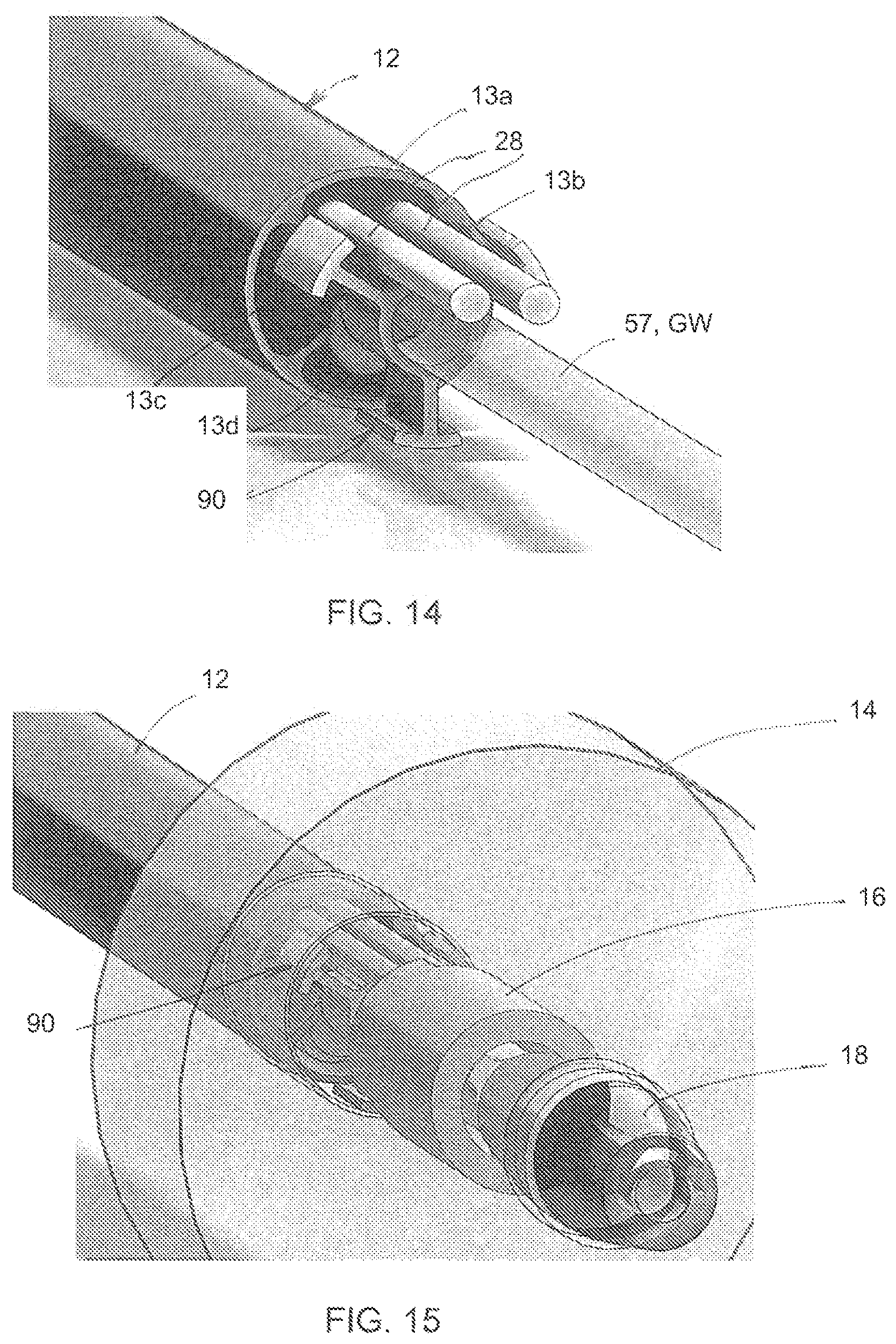 Patent US12102845 Figure 11 – Ultrasound-based neuromodulation system