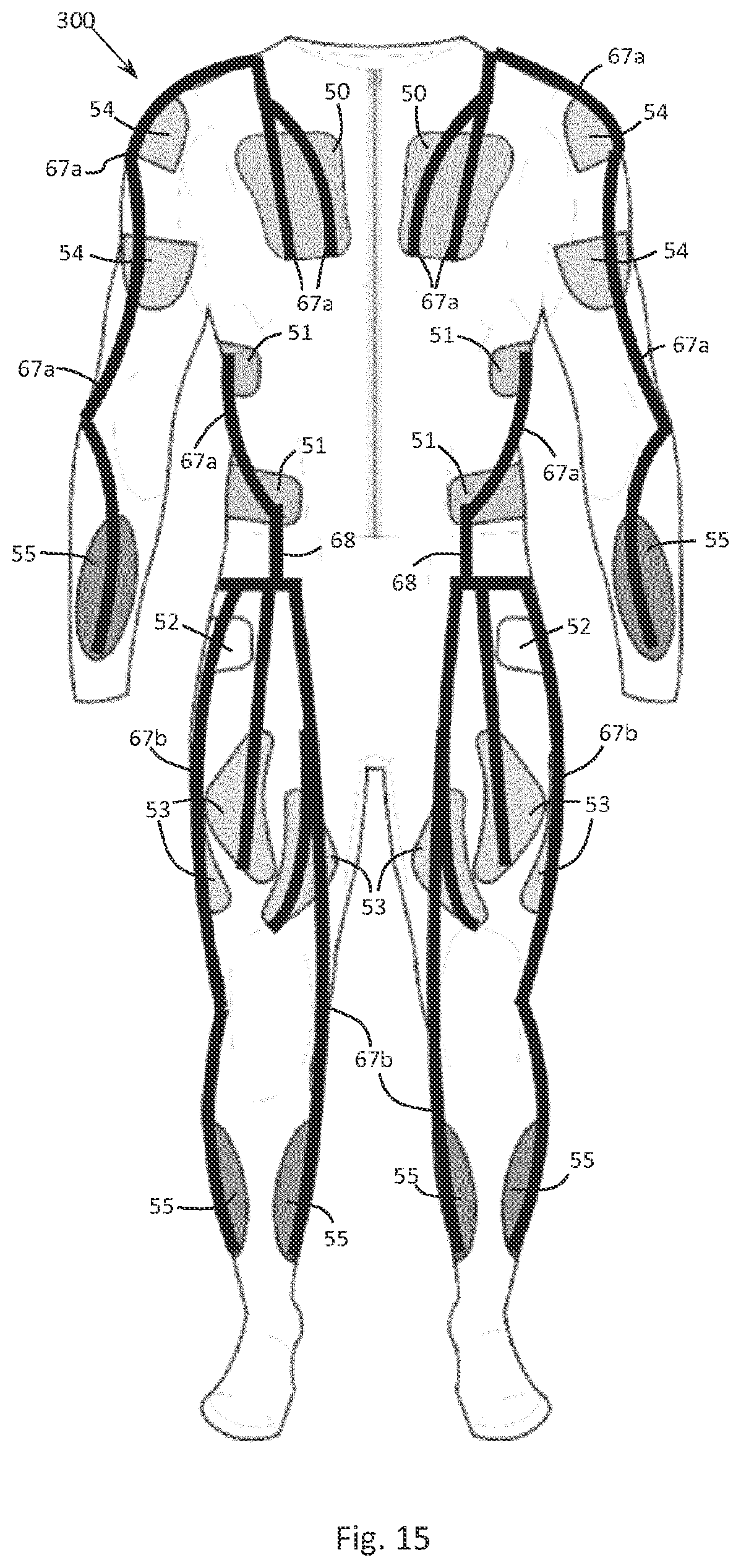 Patent US12102865 Figure 13 – Sports training and physiotherapy garments