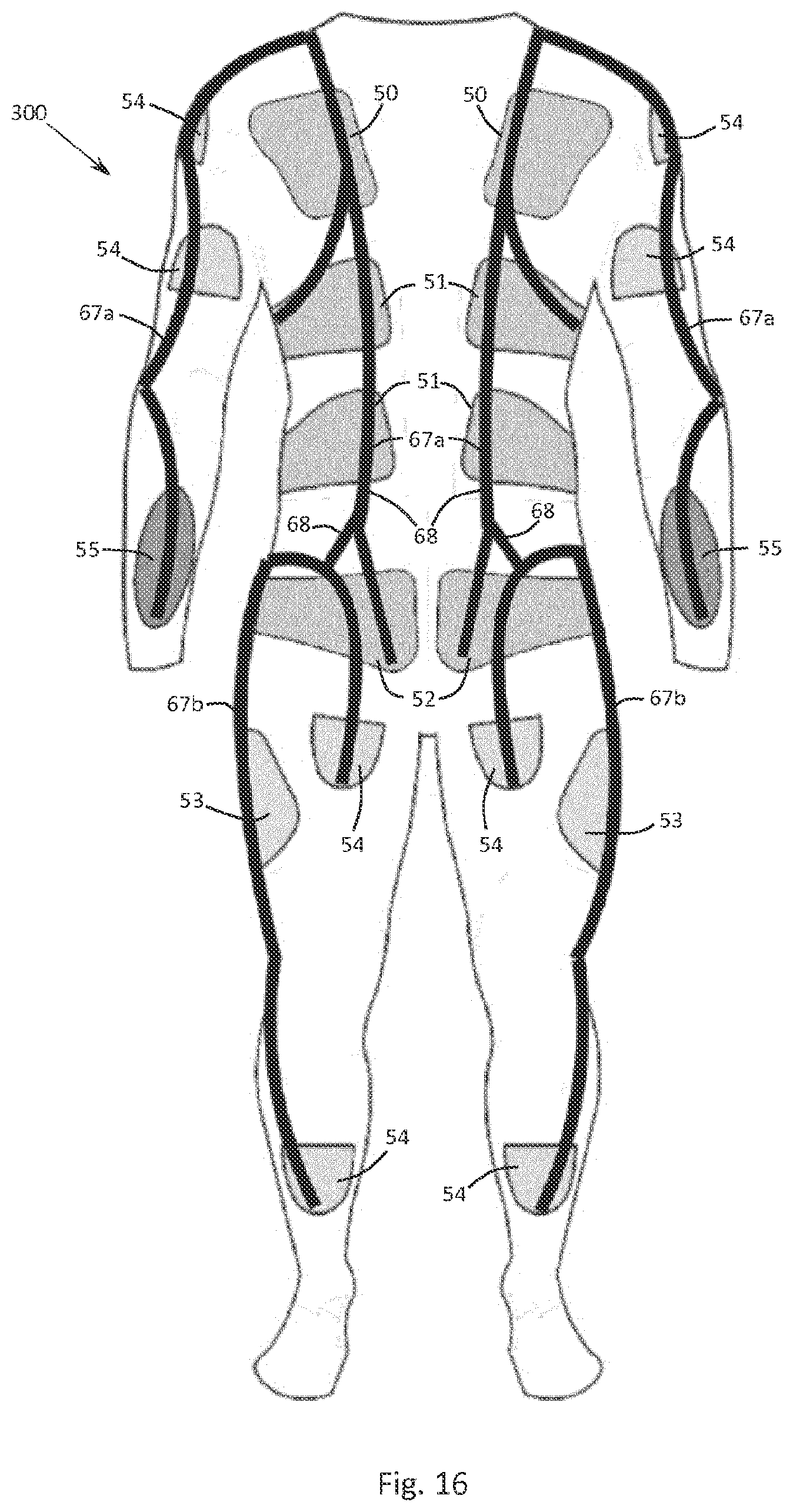 Patent US12102865 Figure 14 – Sports training and physiotherapy garments