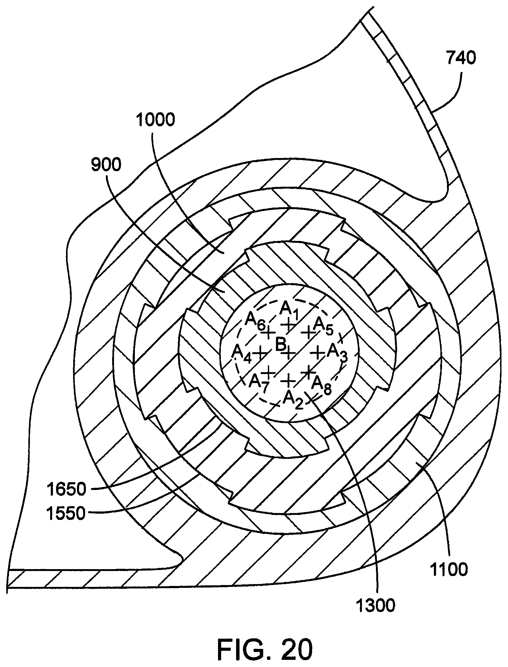 Patent US12102887 Figure 12 – Golf club head