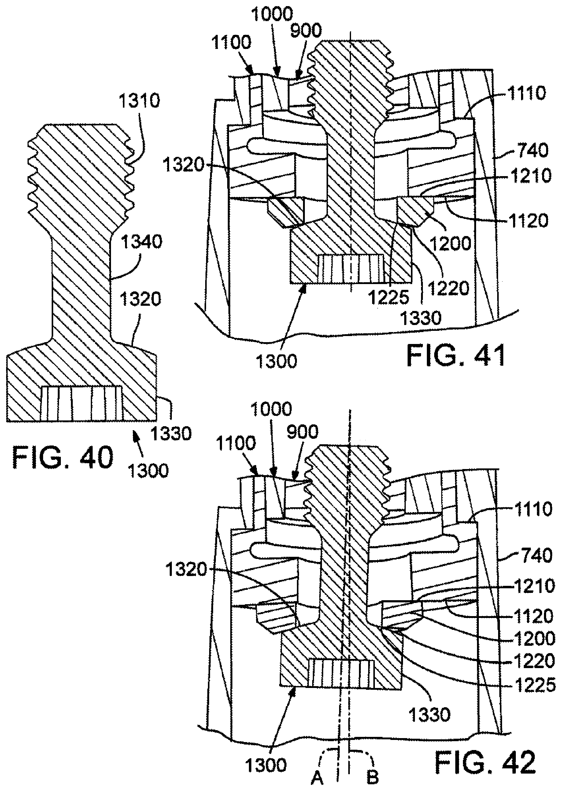 Patent US12102887 Figure 17 – Golf club head