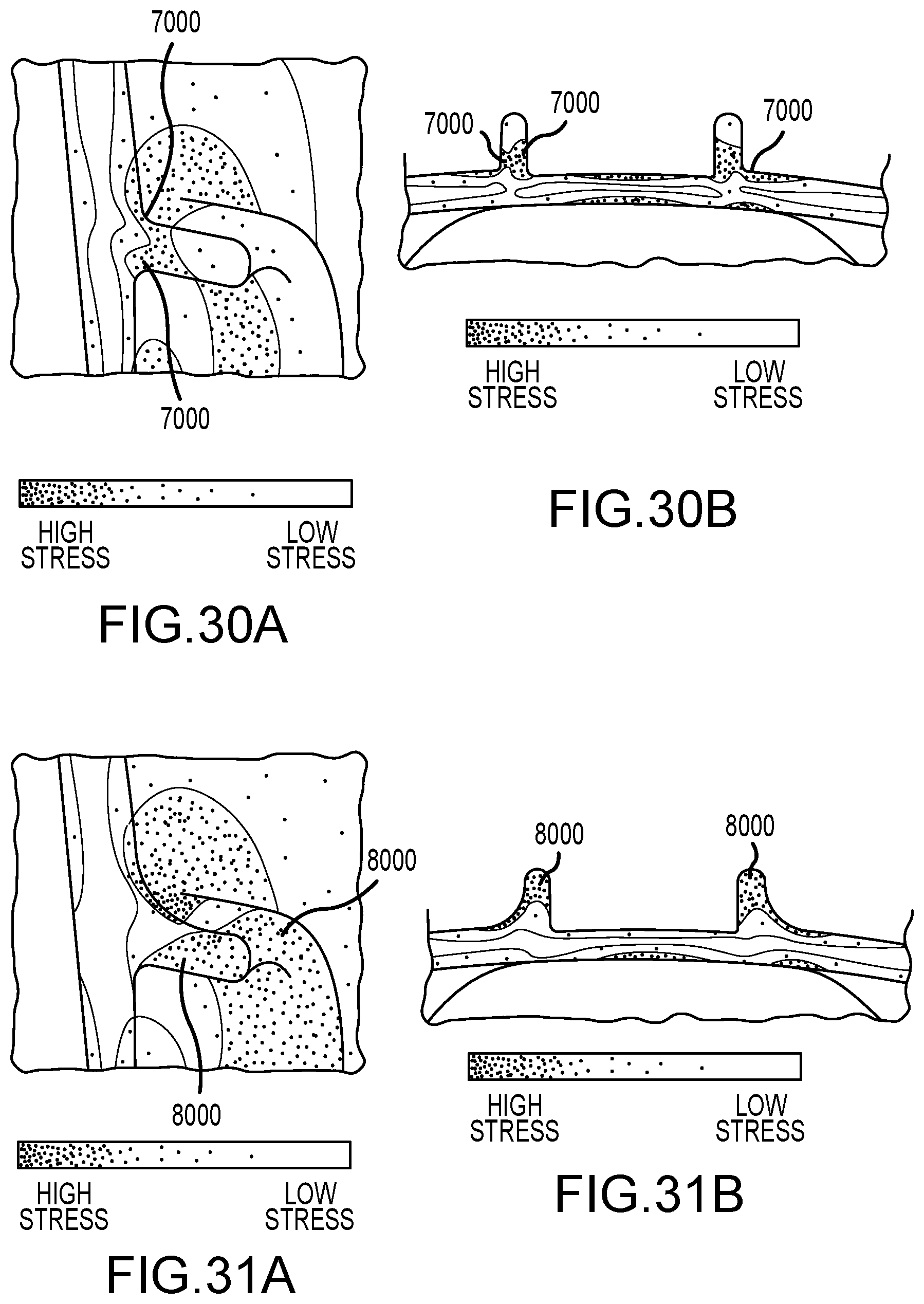 Patent US12102892 Figure 20 – Club heads having reinforced club head faces and related methods