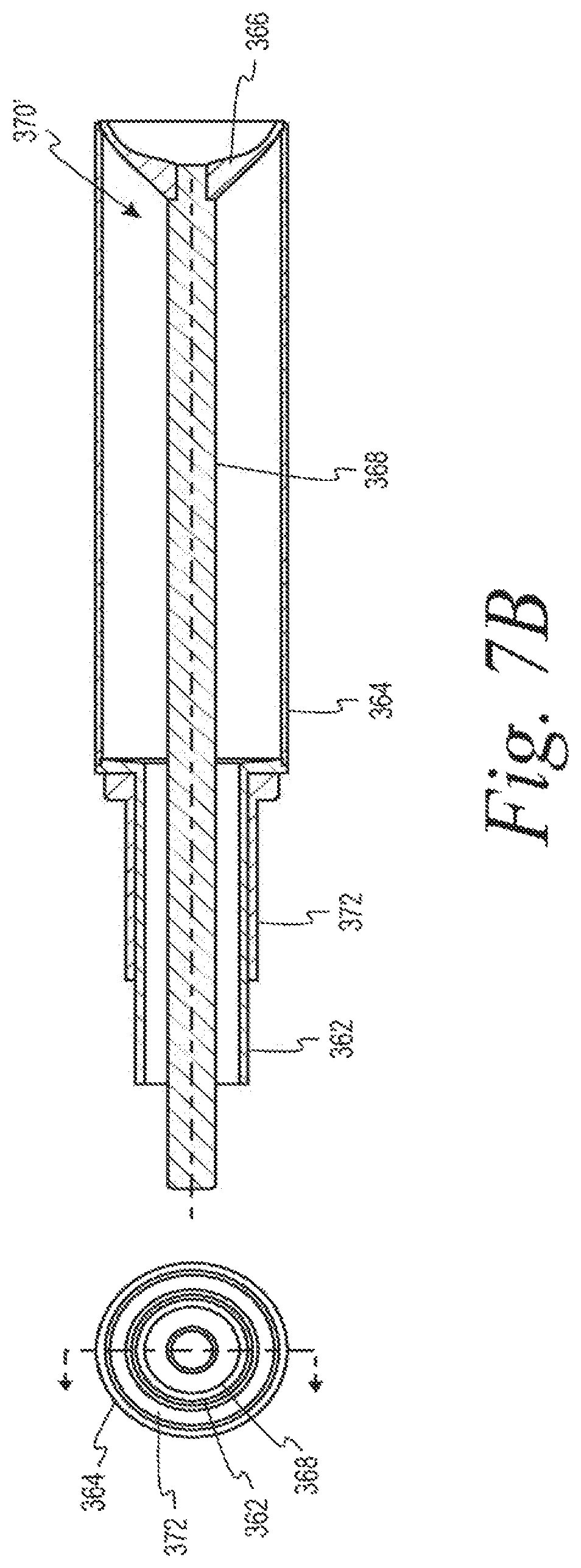 Patent US12103062 Figure 14 – Forming mold for reduction of parting lines