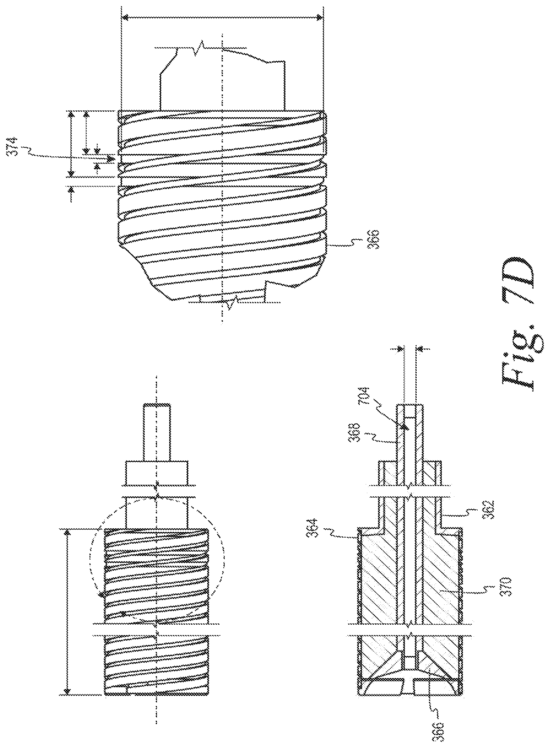 Patent US12103062 Figure 16 – Forming mold for reduction of parting lines