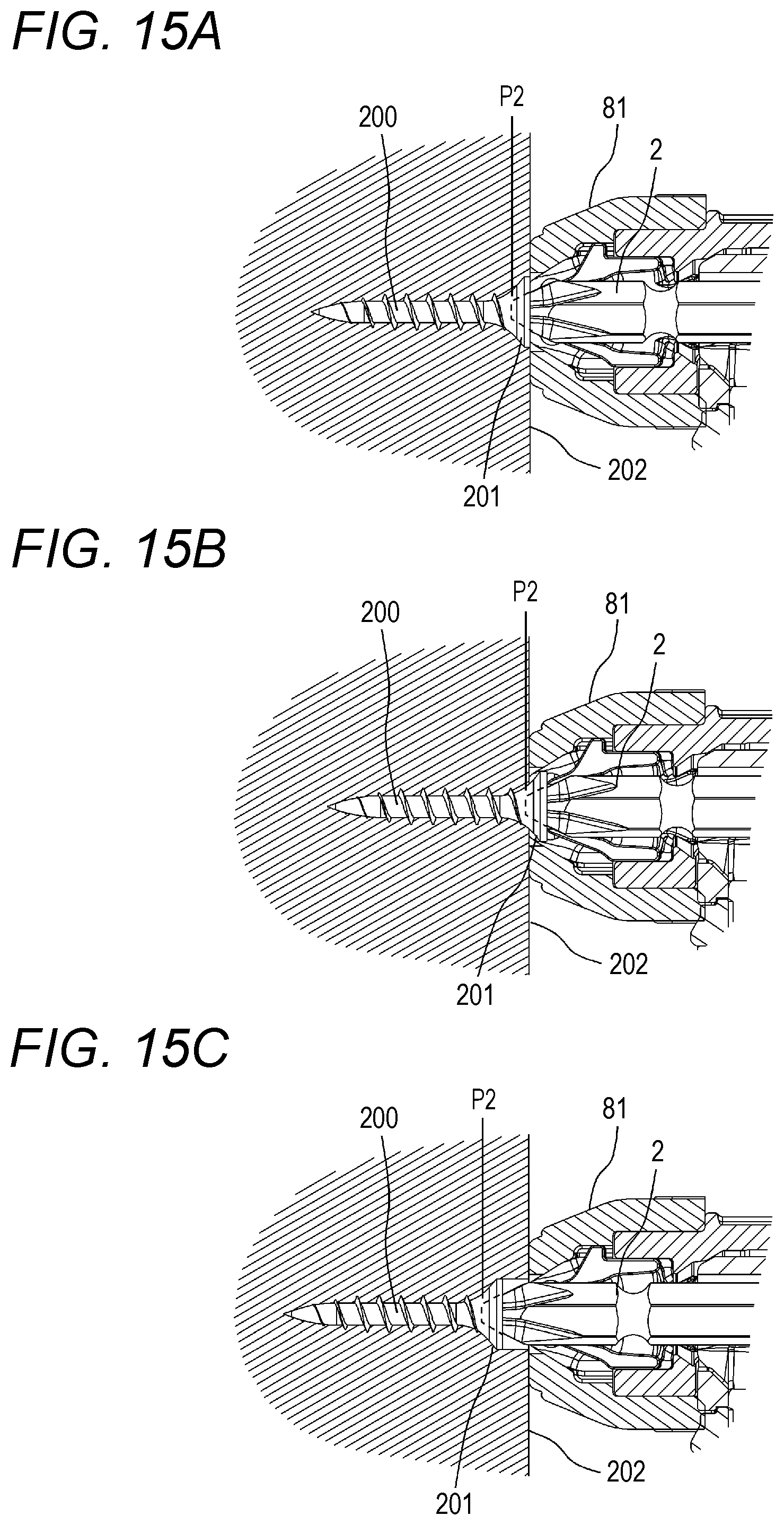 Patent US12103144 Figure 19 – Fastening tool