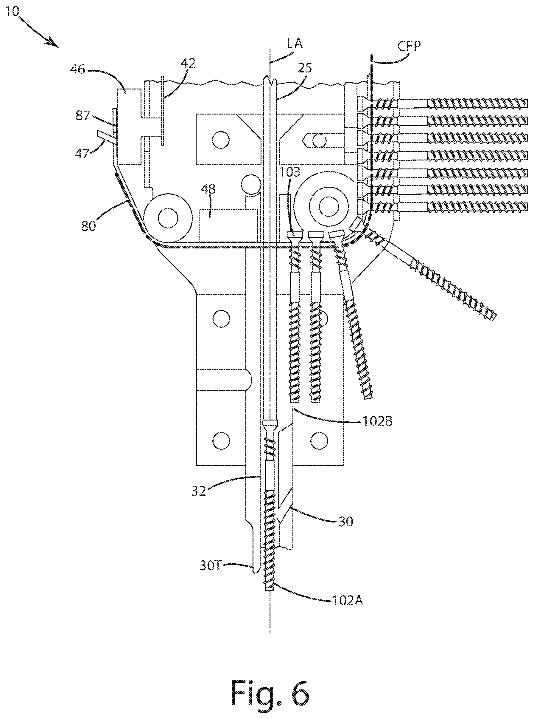 Patent US12103146 Figure 6 – Tension fed fastener installation tool and related methods of use