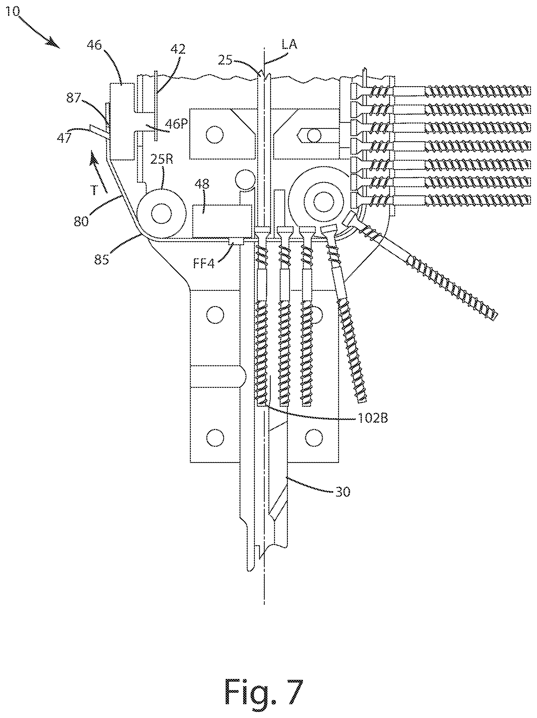 Patent US12103146 Figure 7 – Tension fed fastener installation tool and related methods of use