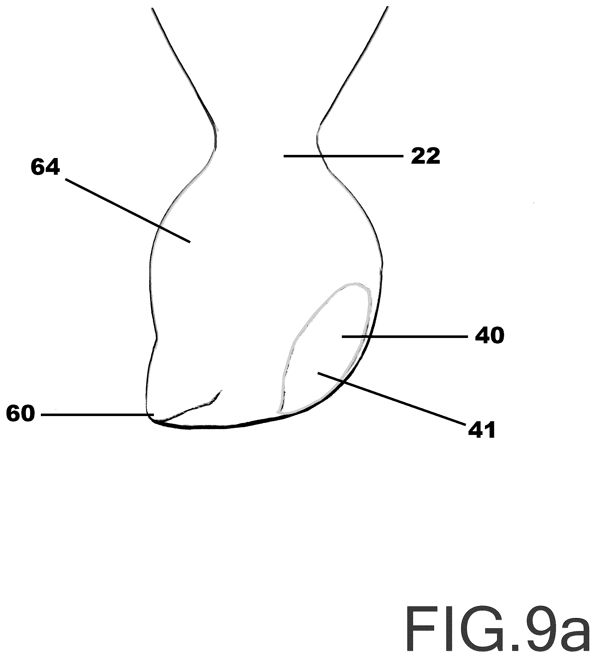 Patent US12103154 Figure 9 – Surface wedge tool