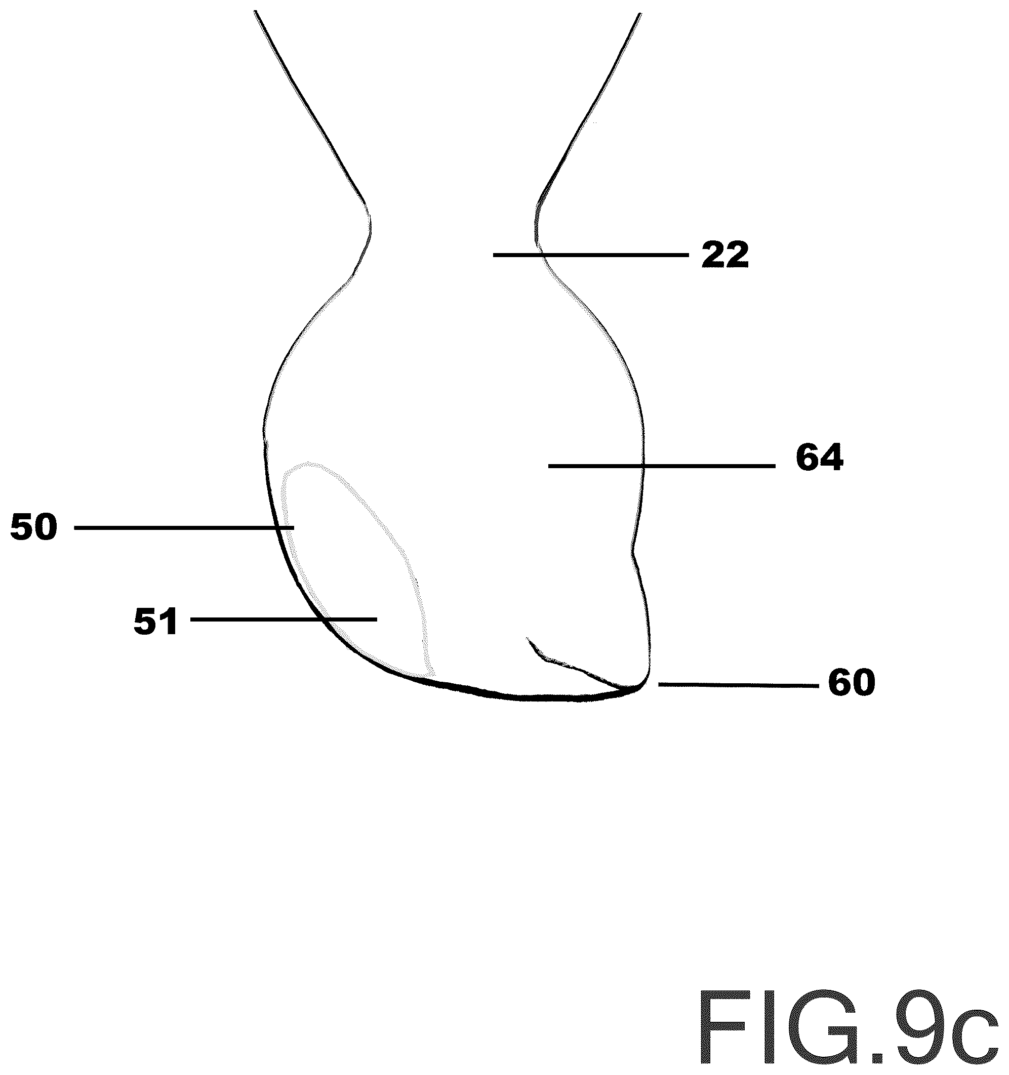 Patent US12103154 Figure 11 – Surface wedge tool