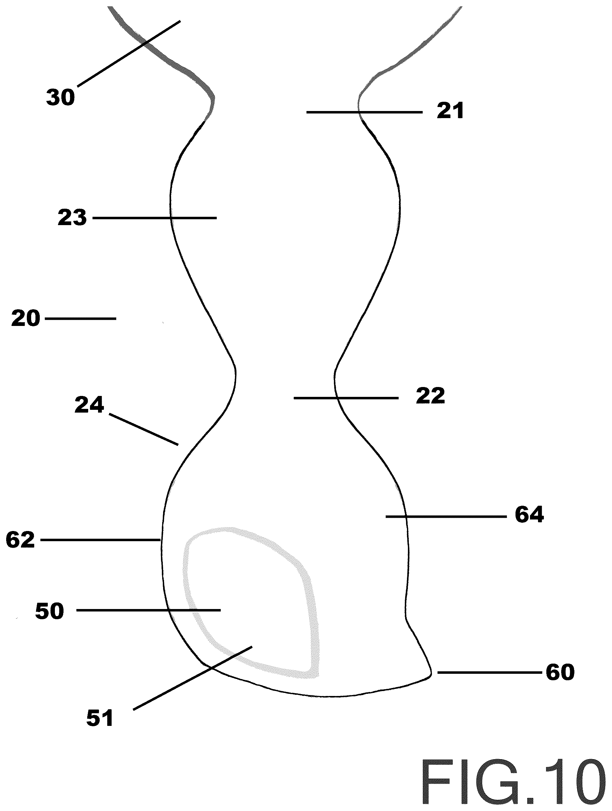 Patent US12103154 Figure 13 – Surface wedge tool