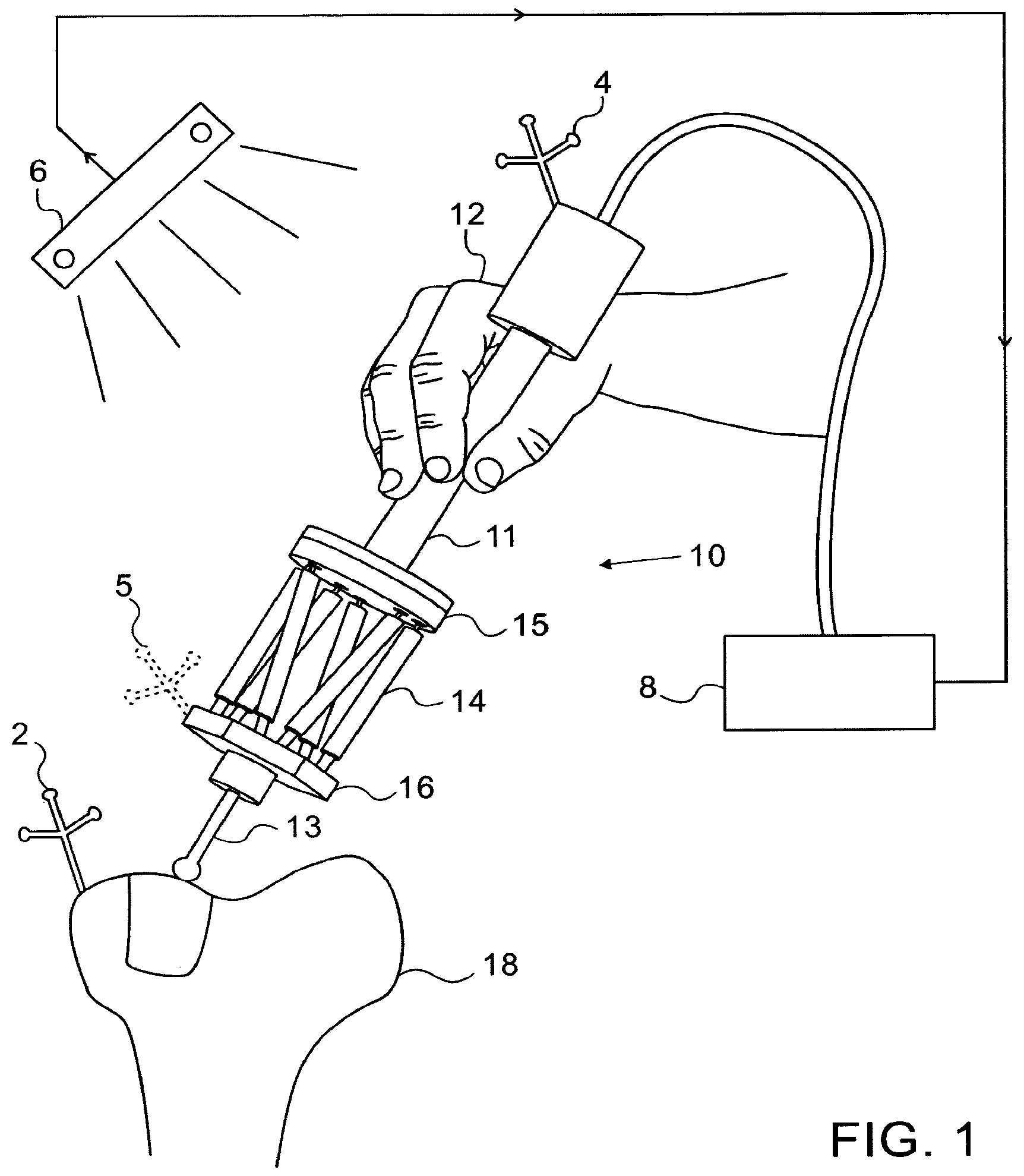 Patent US12103166 Figure 1 – Device for improving the accuracy of manual operations