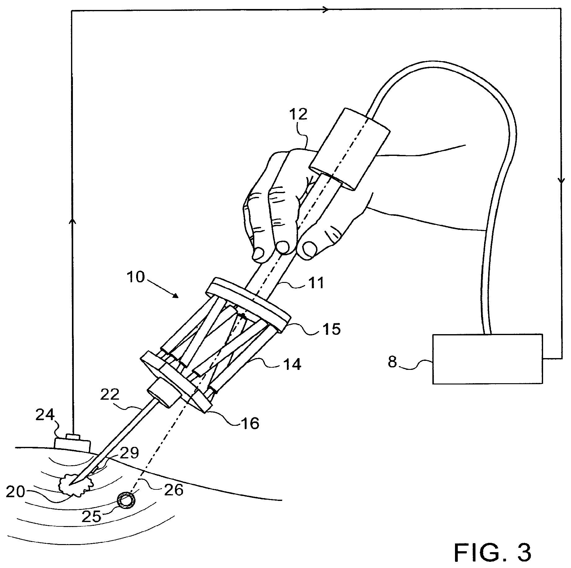 Patent US12103166 Figure 3 – Device for improving the accuracy of manual operations