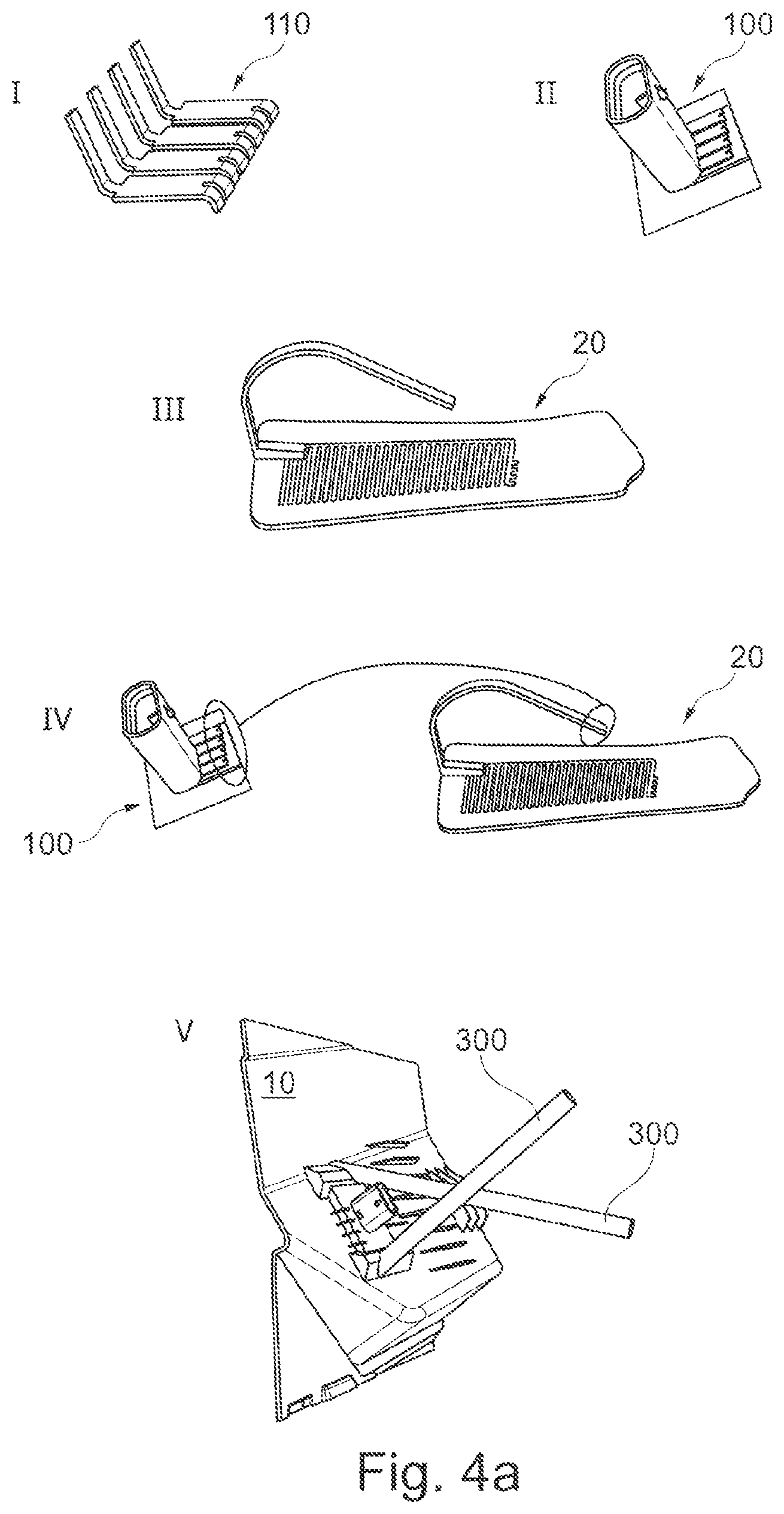 Patent US12103473 Figure 3 – Vehicle interior trim part with an integrated electrical or optical device