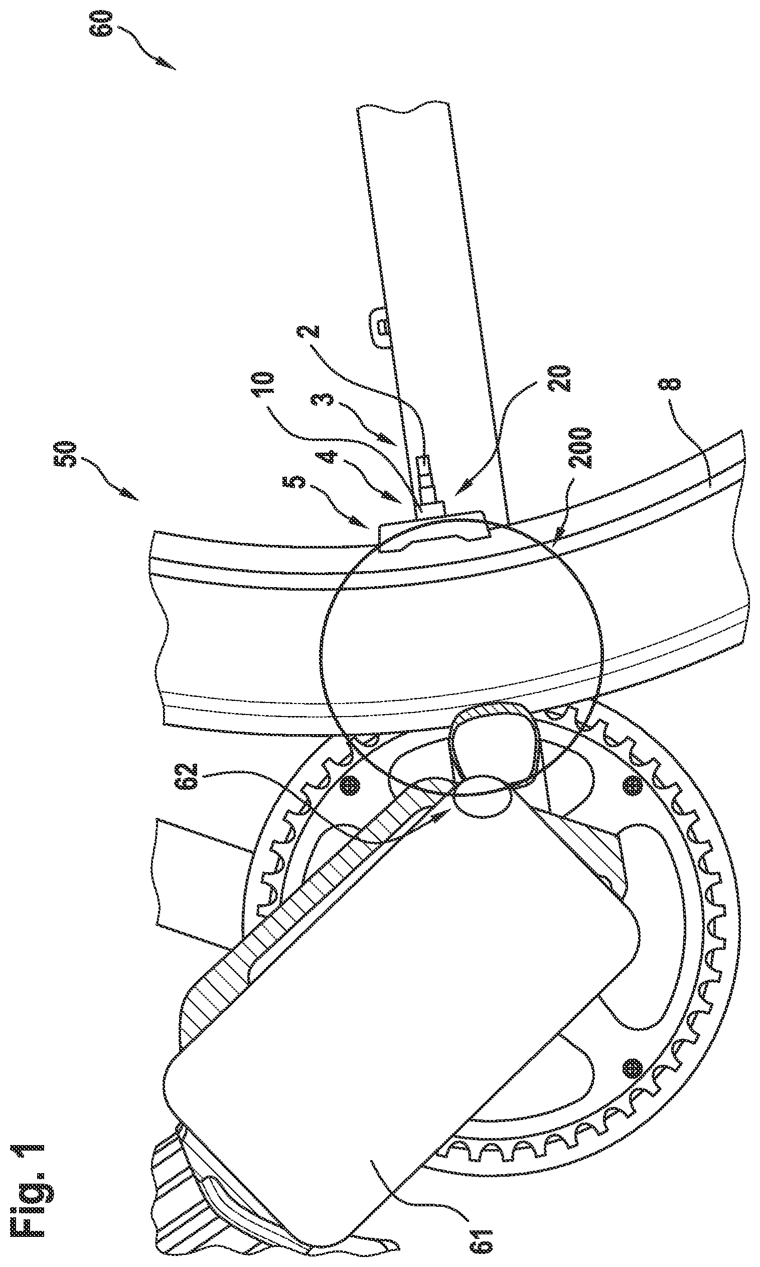 Patent US12103626 Figure 1 – Rim magnet arrangement for fixing a magnet on a rim by way of a stem of a valve