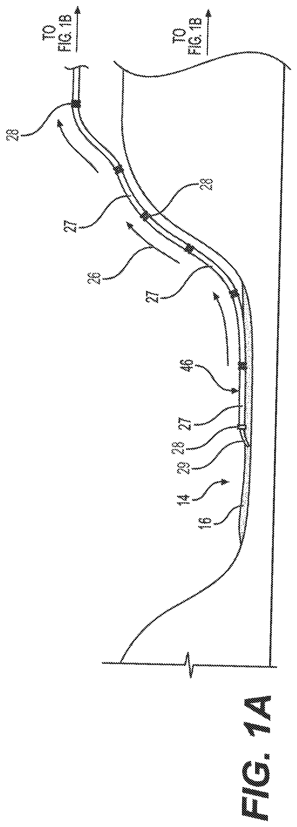 Patent US12103791 Figure 1 – Assemblies and methods for material extraction from retention collections