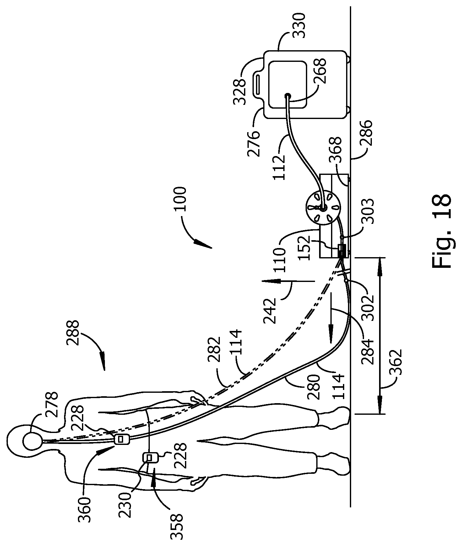 Patent US12103813 Figure 15 – Reel with automatic line extension
