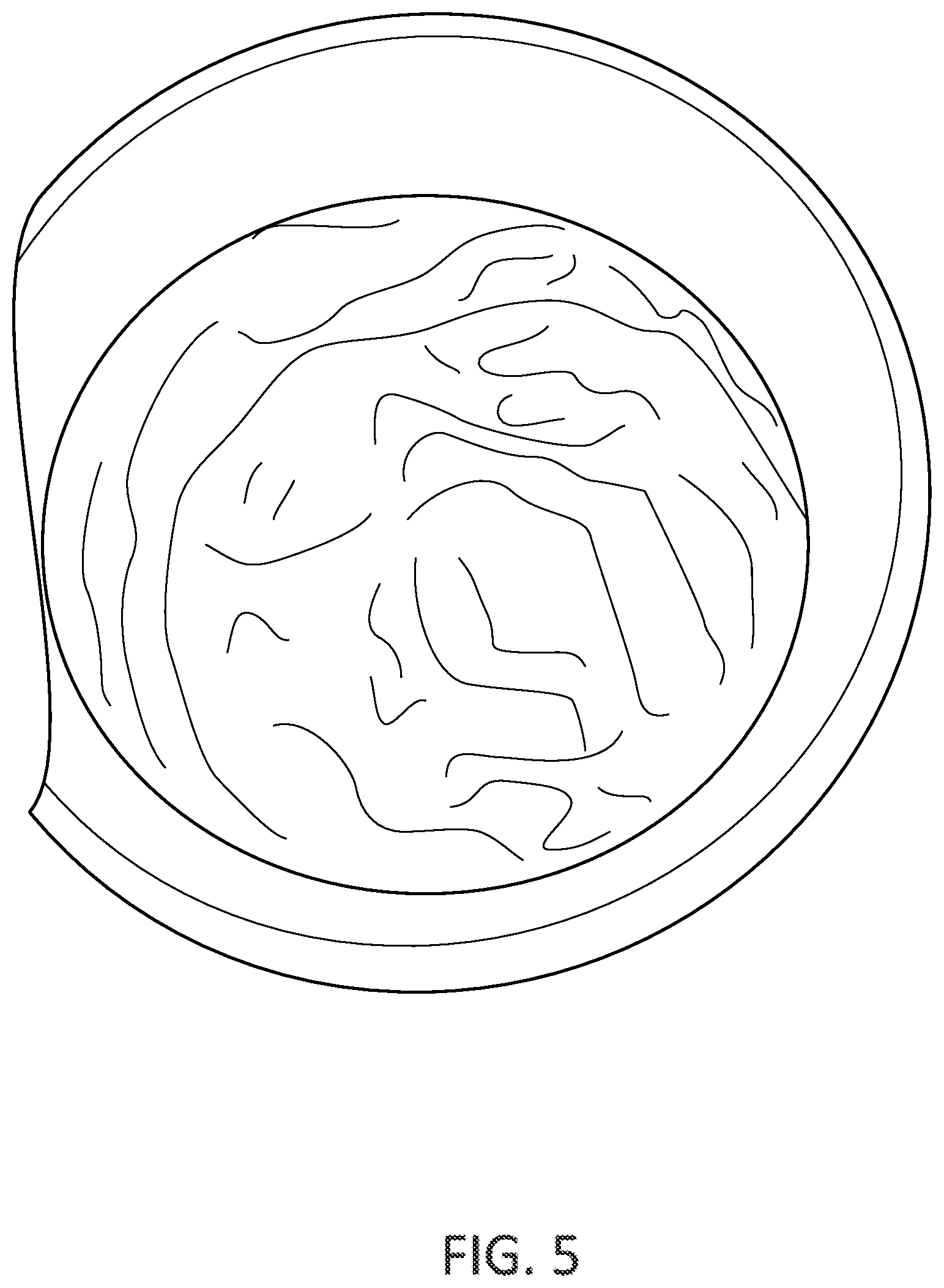 Patent US12103875 Figure 4 – Fluid remanufacturing