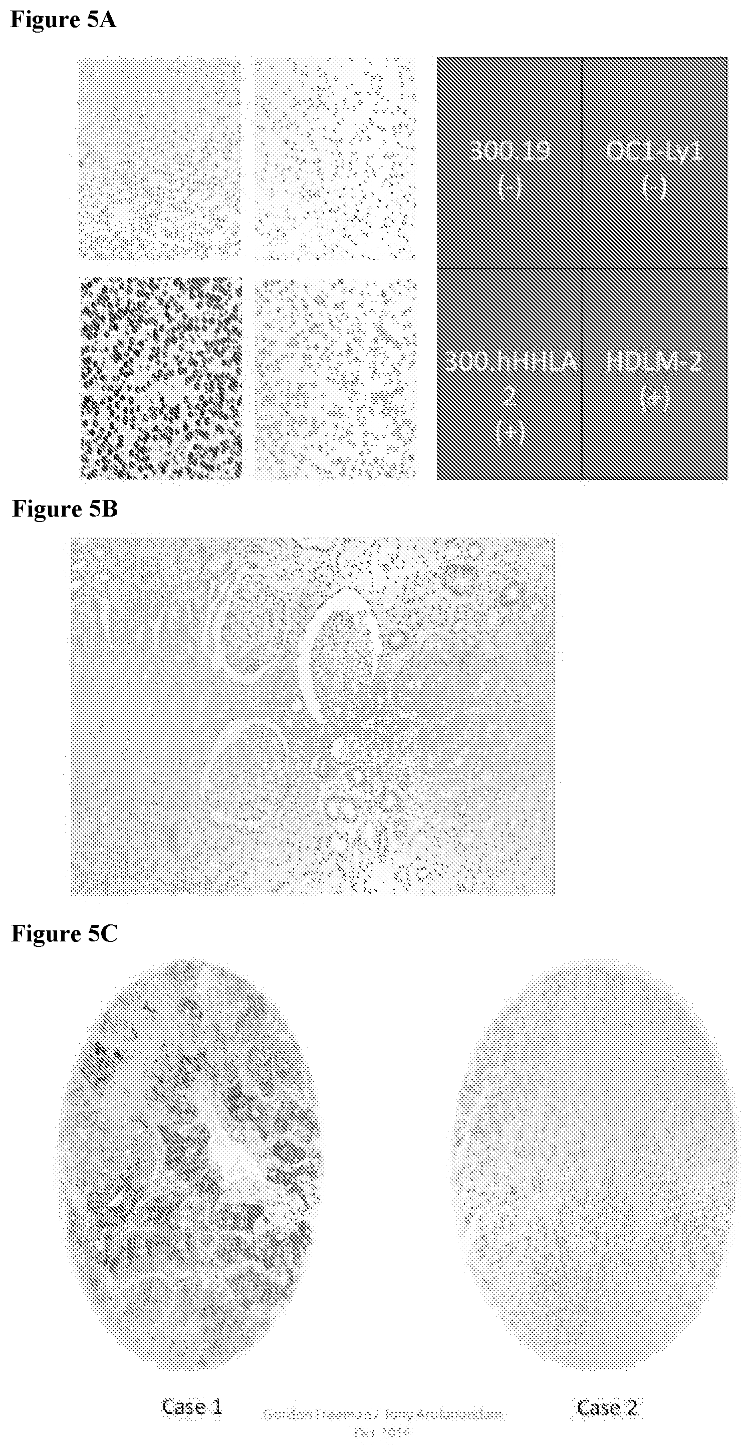 Patent US12103972 Figure 5 – KIR3DL3 as an HHLA2 receptor, anti-HHLA2 antibodies, and uses thereof