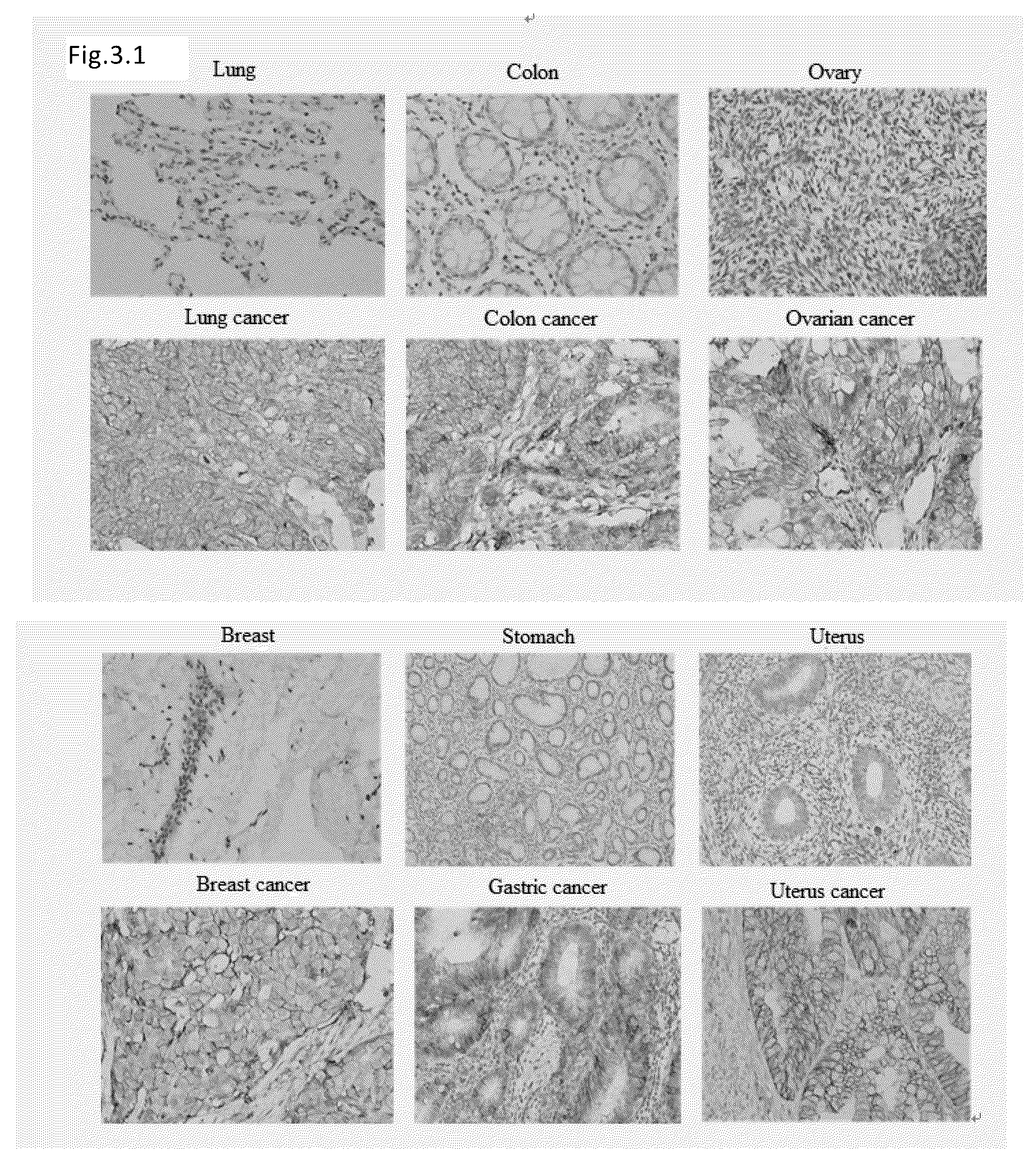 Patent US12103973 Figure 2 – Anti-B7-H3 monoclonal antibody and use thereof in cell therapy