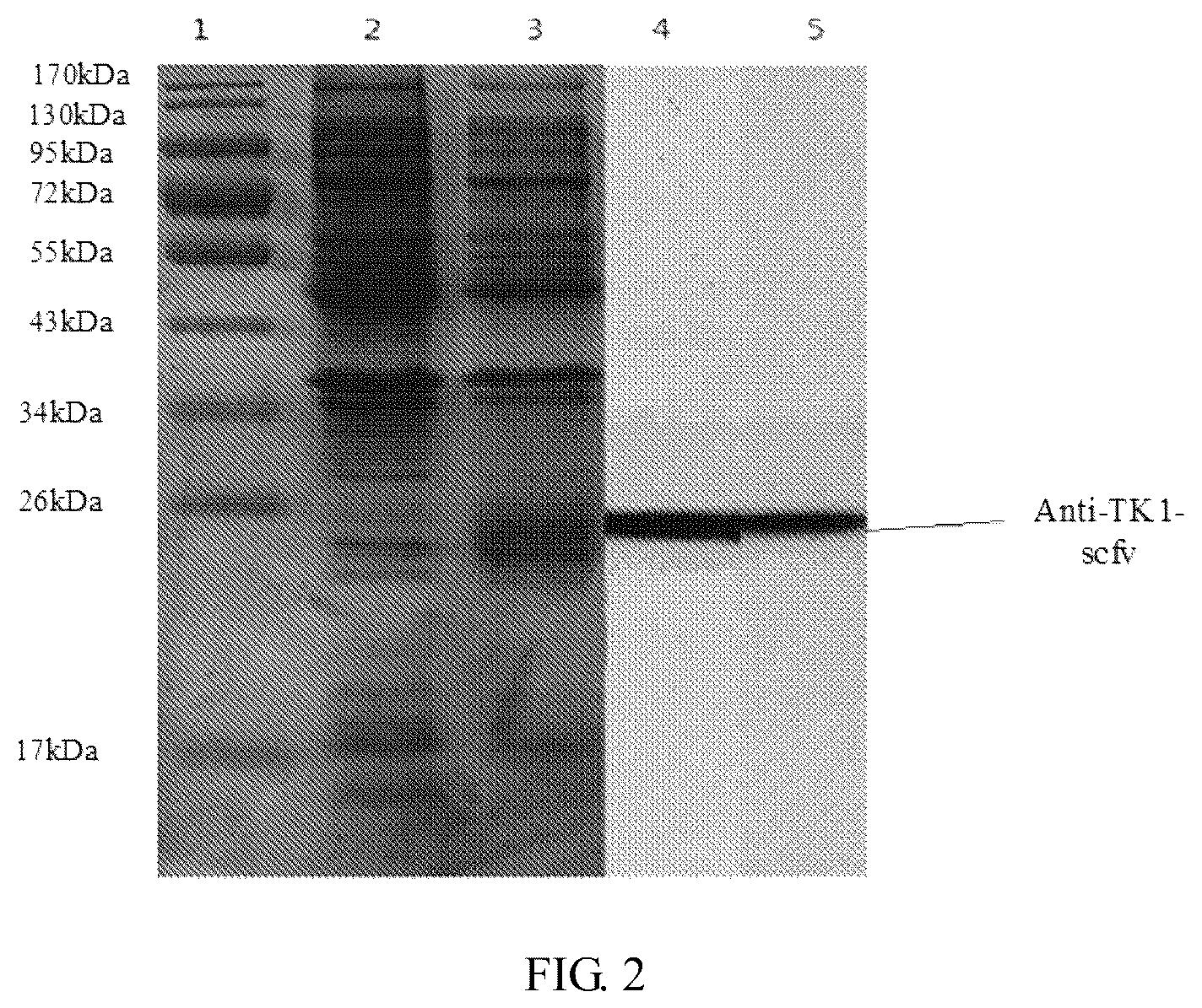 Patent US12103980 Figure 2 – Development of recombinant chicken IGY SCFV antibody raised against human thymidine kinase 1 expressed in prokaryotic cells and use thereof