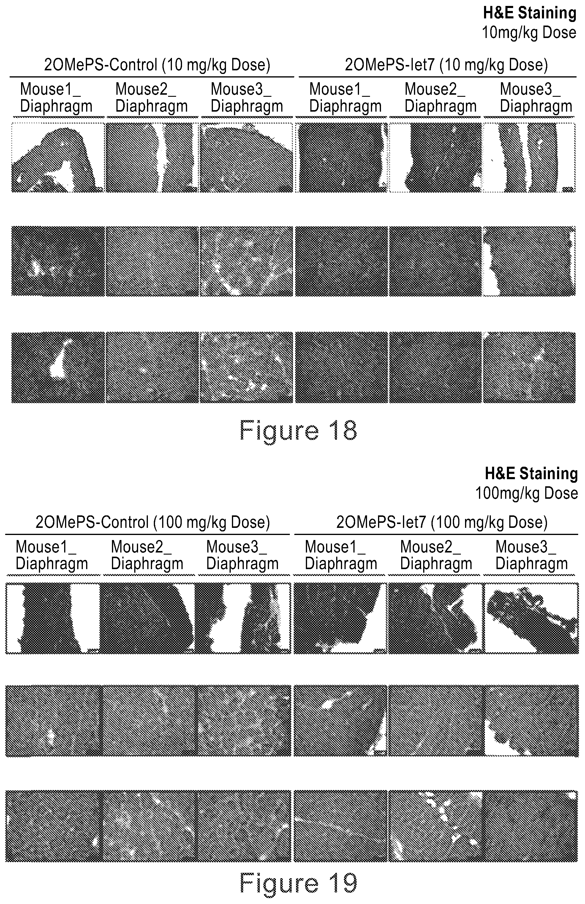 Patent US12104152 Figure 13 – 2′F-ANA-LET7 mediated utrophin upregulation for DMD therapy