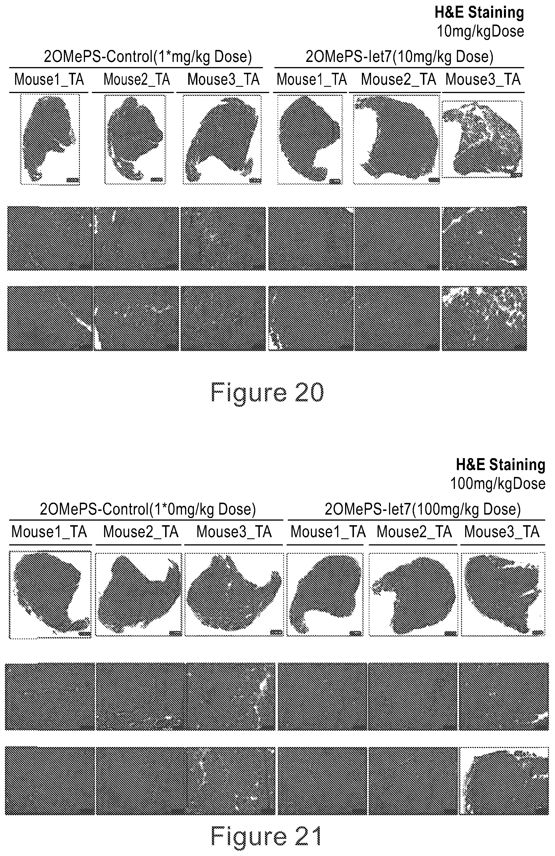 Patent US12104152 Figure 14 – 2′F-ANA-LET7 mediated utrophin upregulation for DMD therapy
