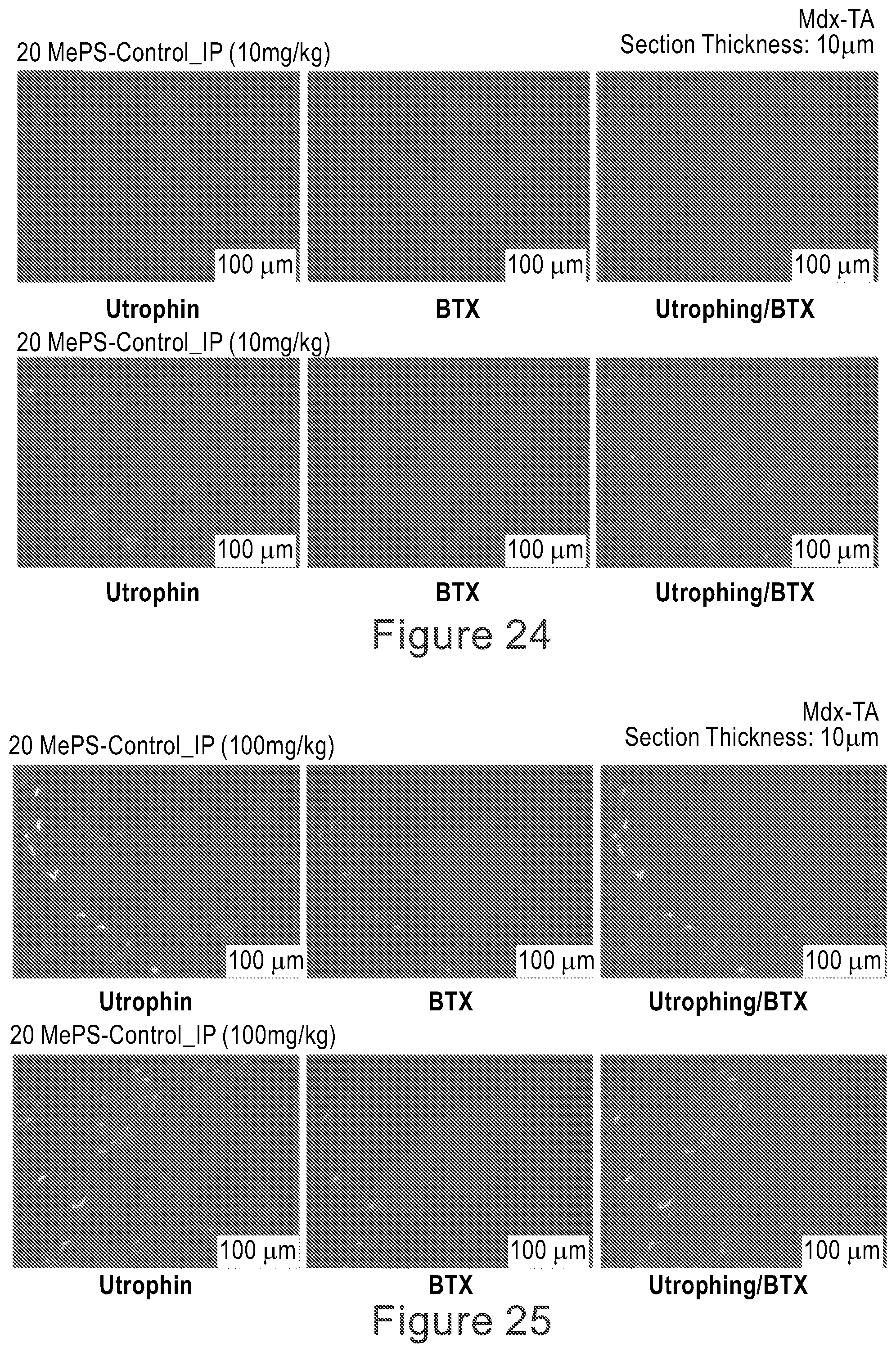 Patent US12104152 Figure 17 – 2′F-ANA-LET7 mediated utrophin upregulation for DMD therapy