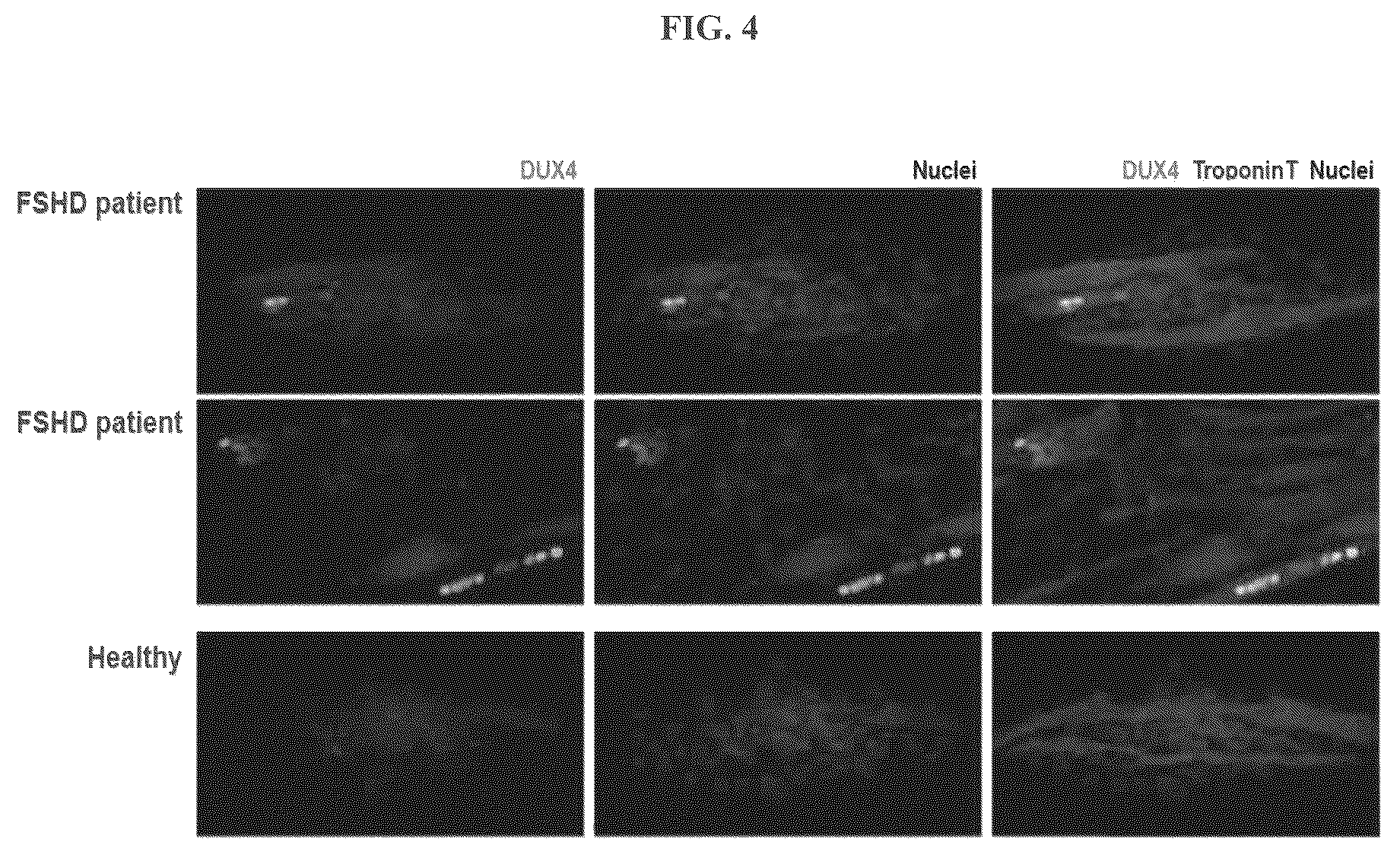 Patent US12104156 Figure 4 – Compositions and methods of treating facioscapulohumeral muscular dystrophy