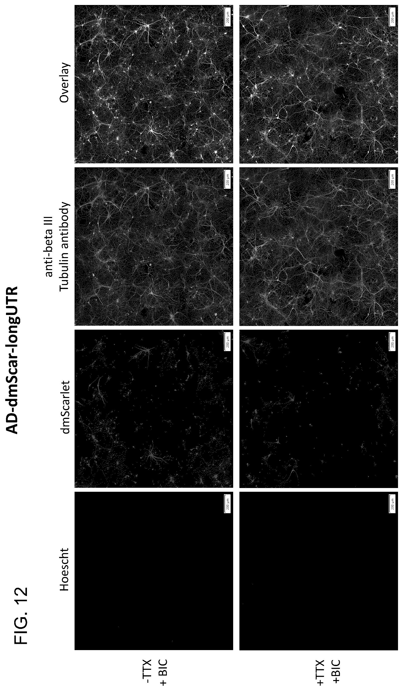 Patent US12104163 Figure 18 – Adeno-associated virus vectors for treatment of Rett syndrome