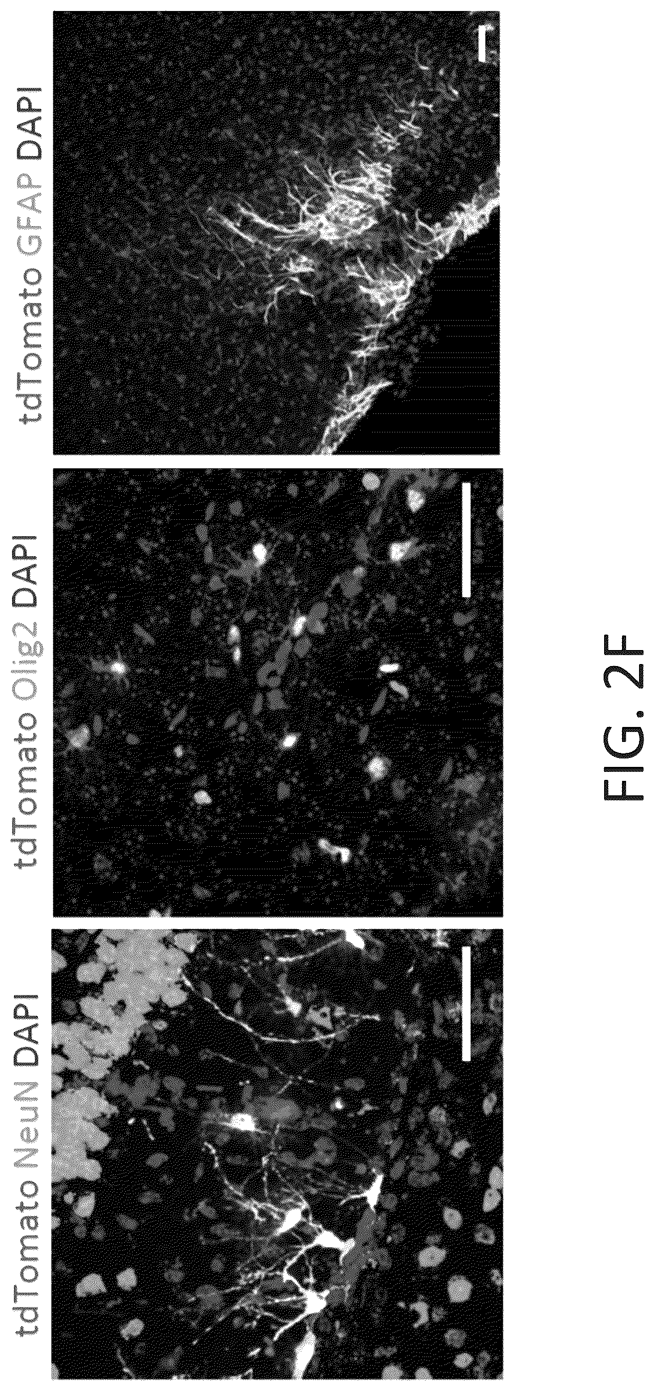 Patent US12104169 Figure 10 – Chemical reprogramming to generate neuronal cells