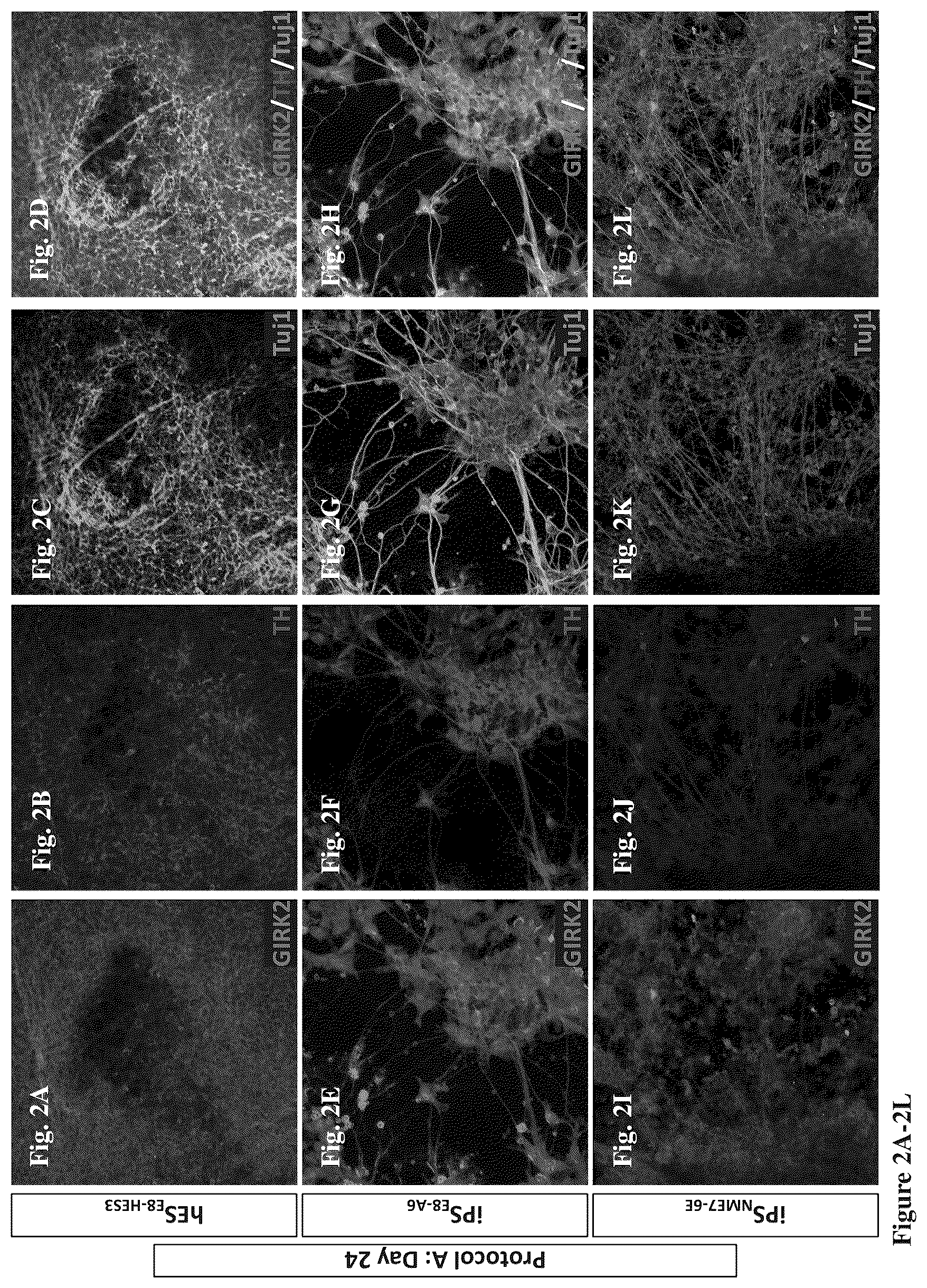 Patent US12104170 Figure 4 – Methods for deriving dopaminergic neurons from pluripotent stem cells