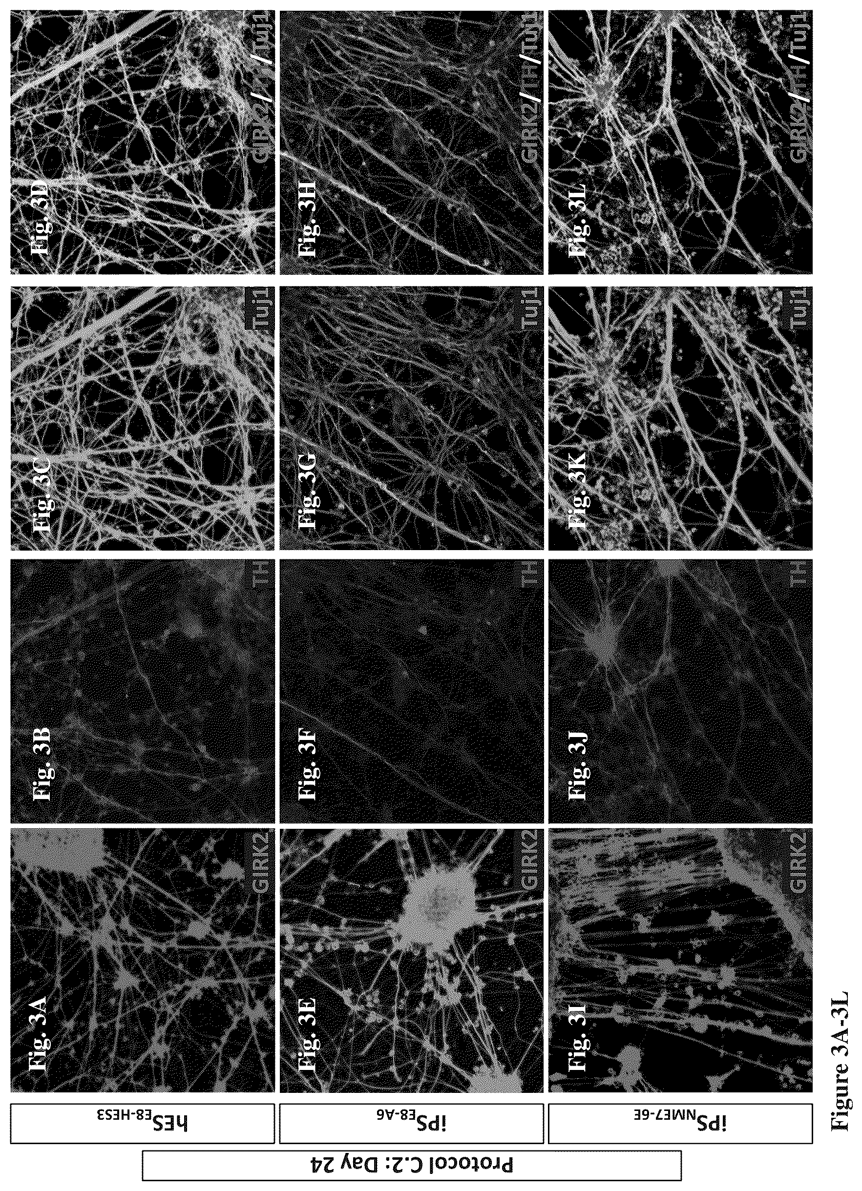 Patent US12104170 Figure 5 – Methods for deriving dopaminergic neurons from pluripotent stem cells