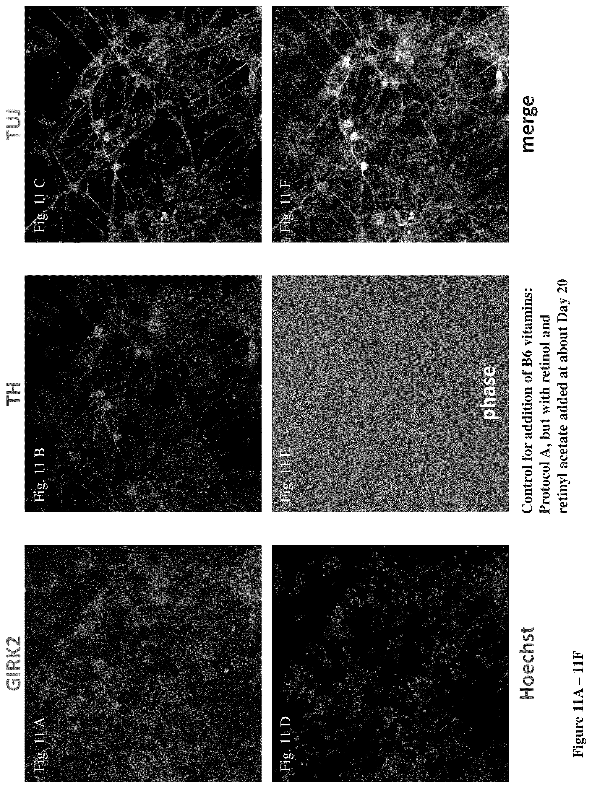 Patent US12104170 Figure 13 – Methods for deriving dopaminergic neurons from pluripotent stem cells