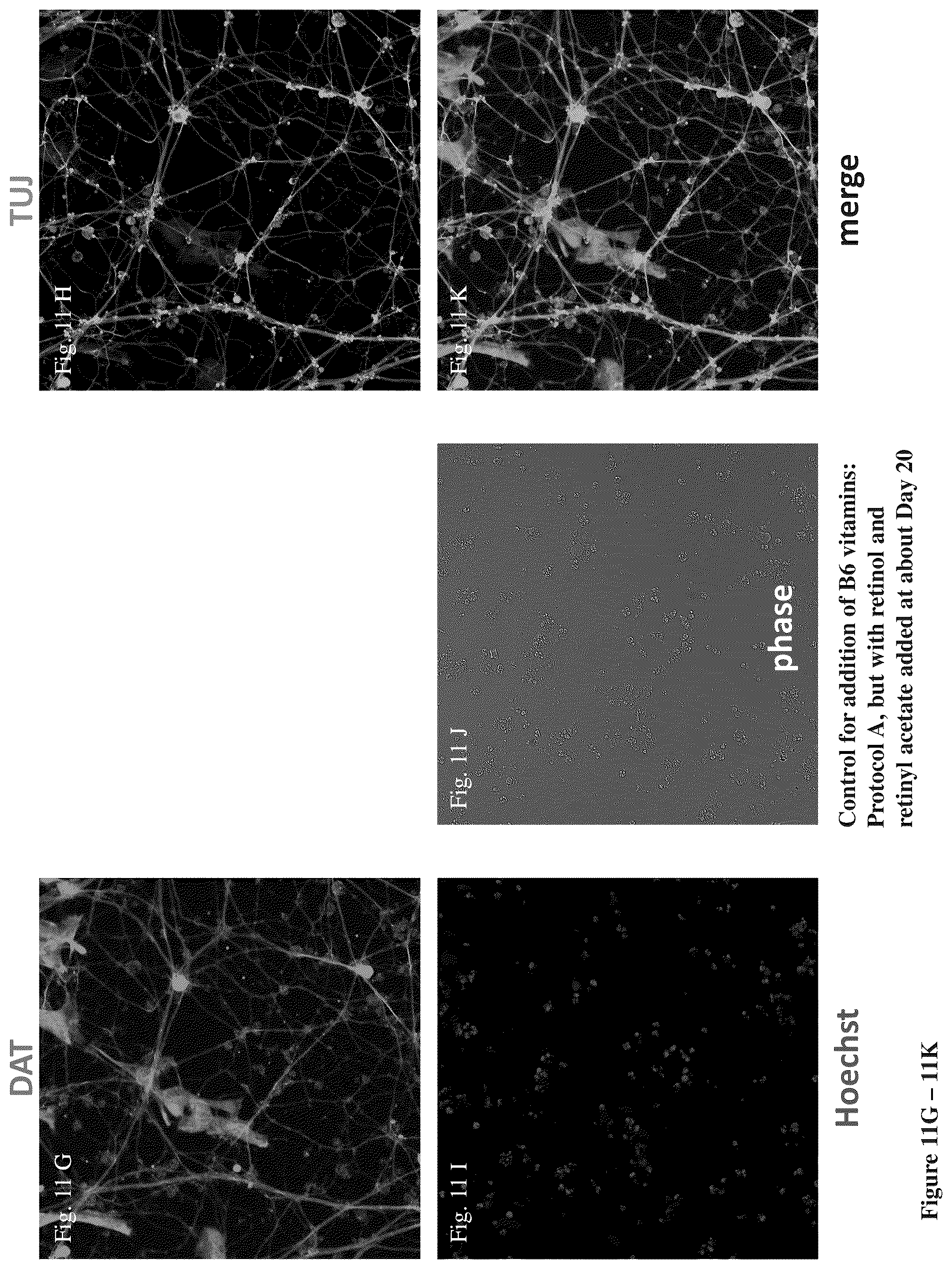Patent US12104170 Figure 14 – Methods for deriving dopaminergic neurons from pluripotent stem cells