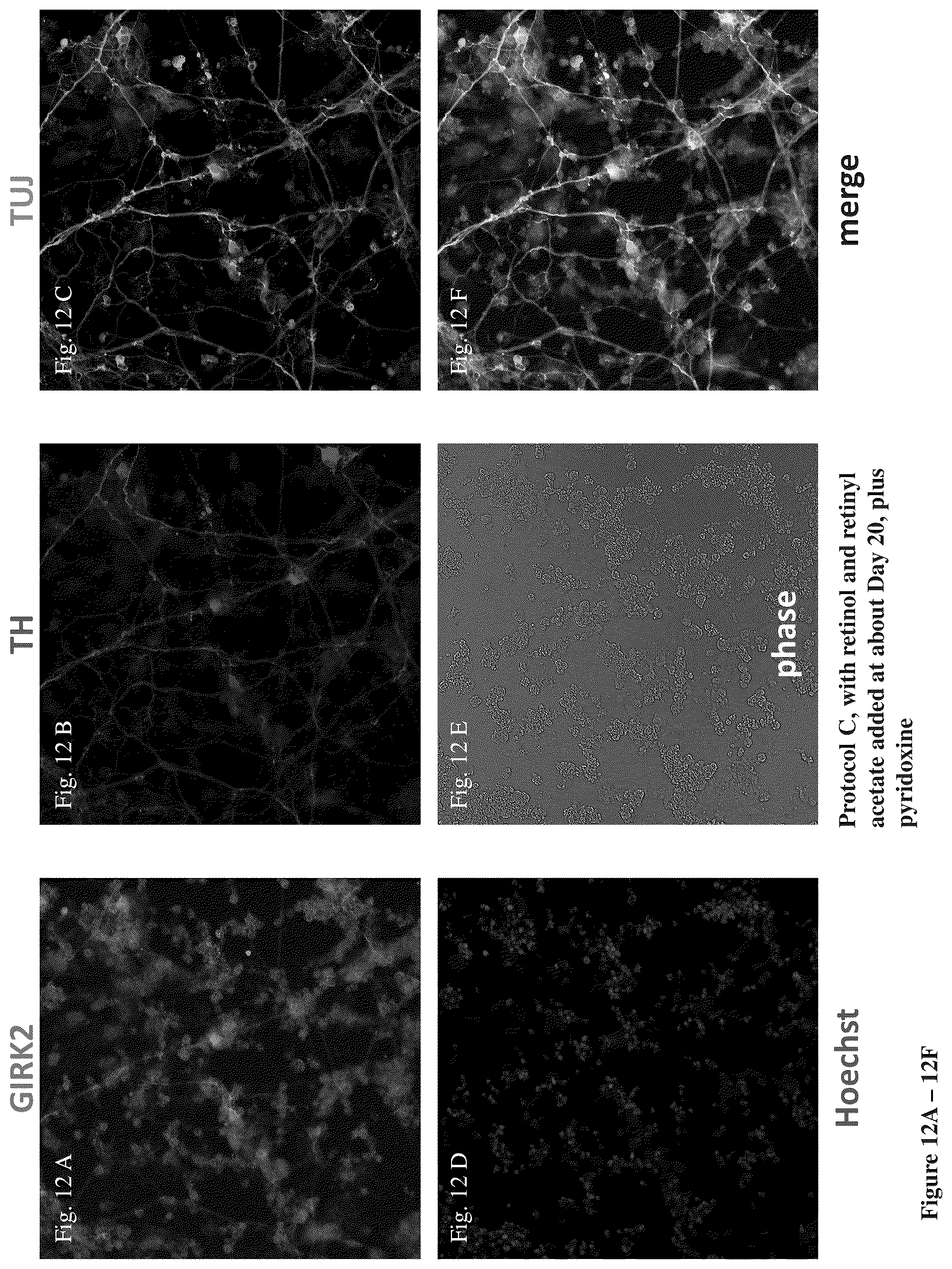 Patent US12104170 Figure 15 – Methods for deriving dopaminergic neurons from pluripotent stem cells