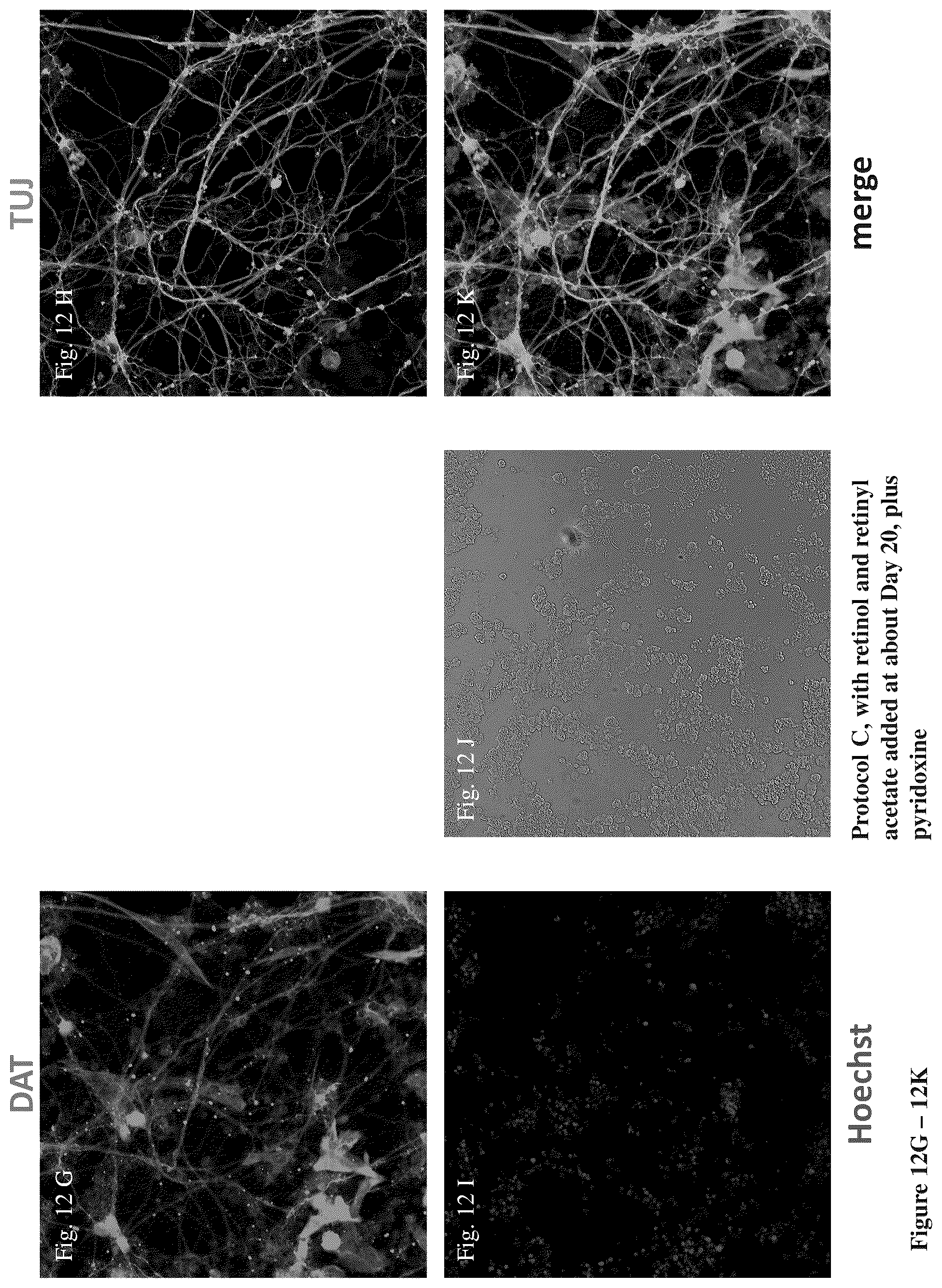 Patent US12104170 Figure 16 – Methods for deriving dopaminergic neurons from pluripotent stem cells