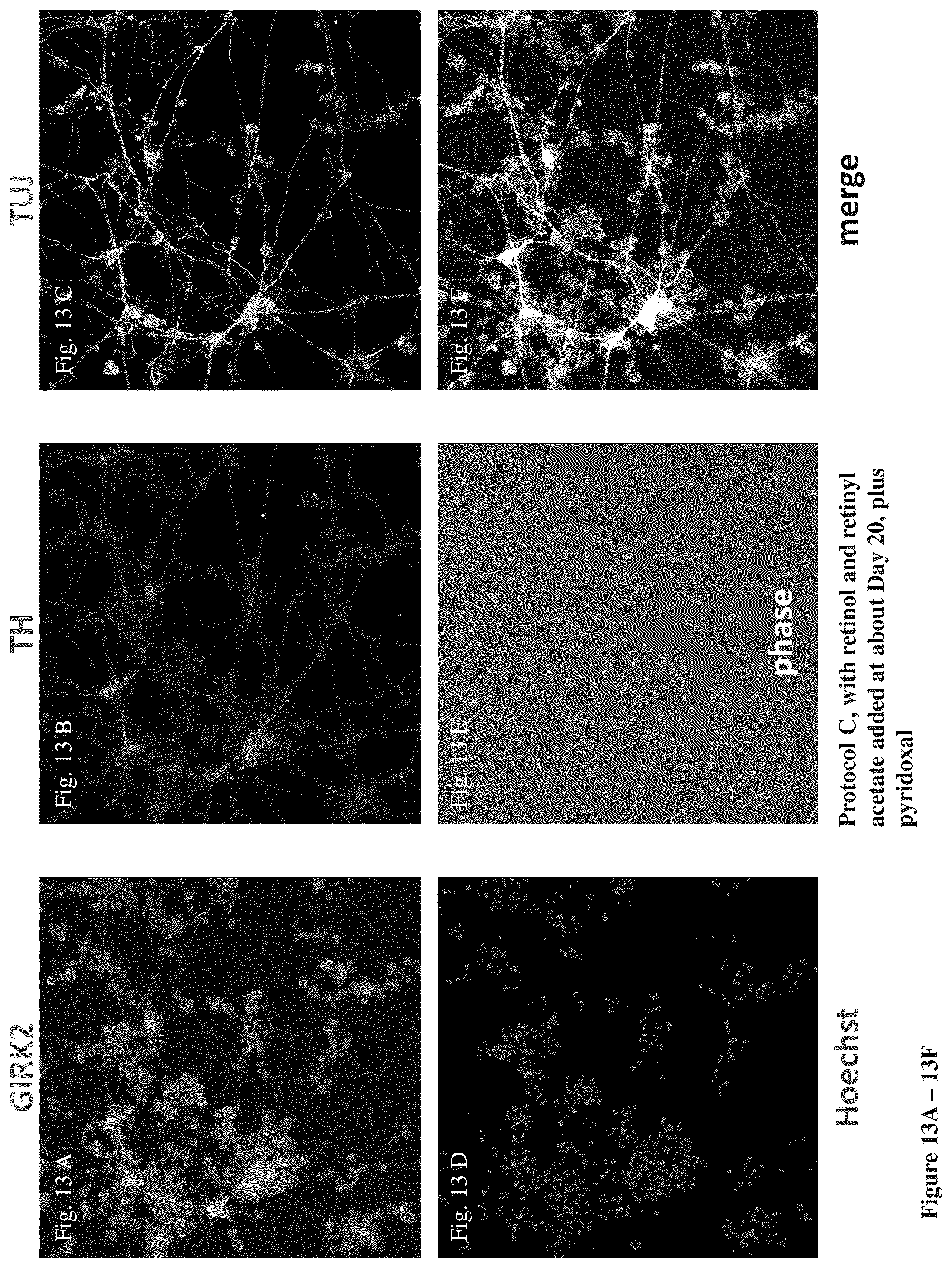 Patent US12104170 Figure 17 – Methods for deriving dopaminergic neurons from pluripotent stem cells