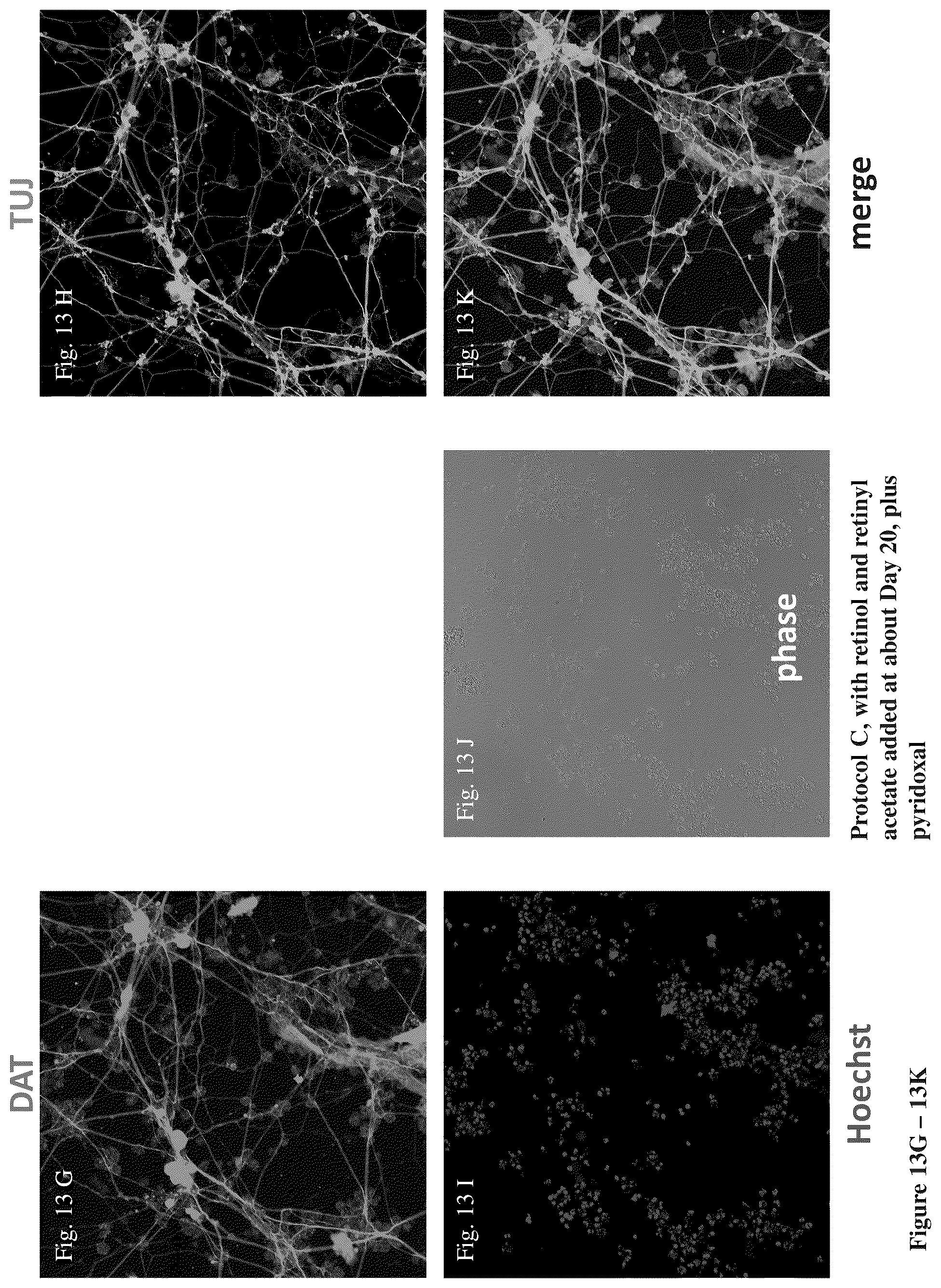 Patent US12104170 Figure 18 – Methods for deriving dopaminergic neurons from pluripotent stem cells