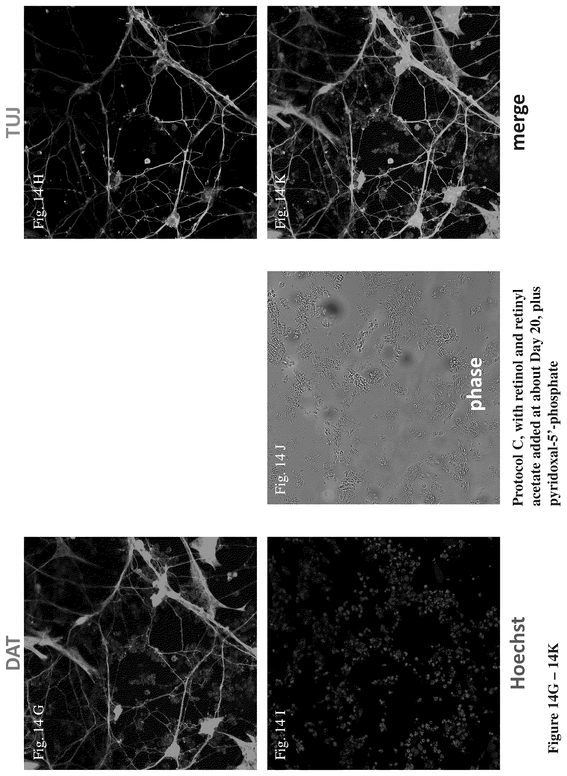 Patent US12104170 Figure 20 – Methods for deriving dopaminergic neurons from pluripotent stem cells